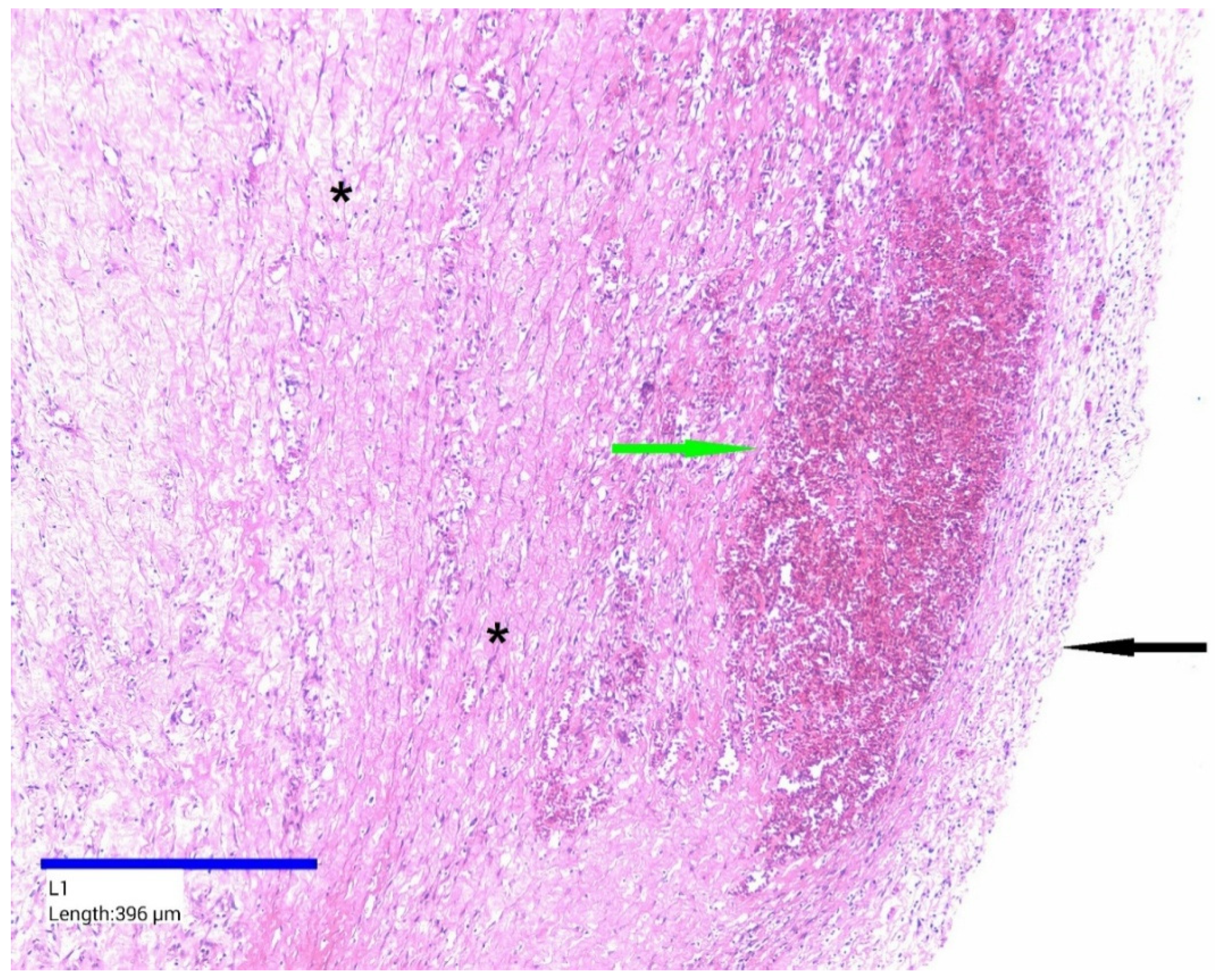 Jcm 14 04888 g006 Jcm 14 04888 g006