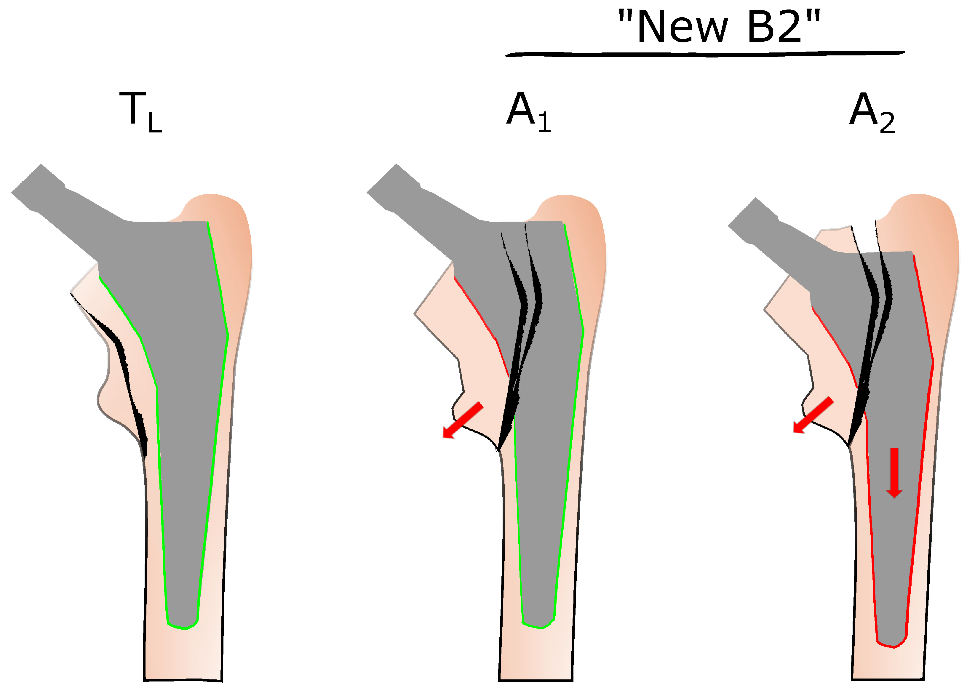 Jcm 14 04896 g001 Jcm 14 04896 g001