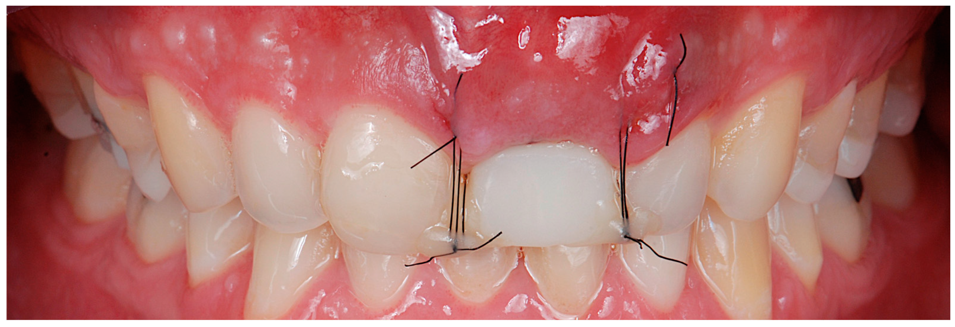 Jcm 14 04974 g008