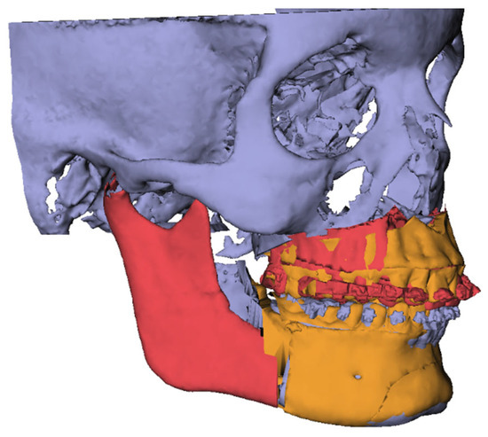 META Muscle Germa 4Step Shape Muscle Shape - Figure 10.1, Shape, Diagram, Description Diagram