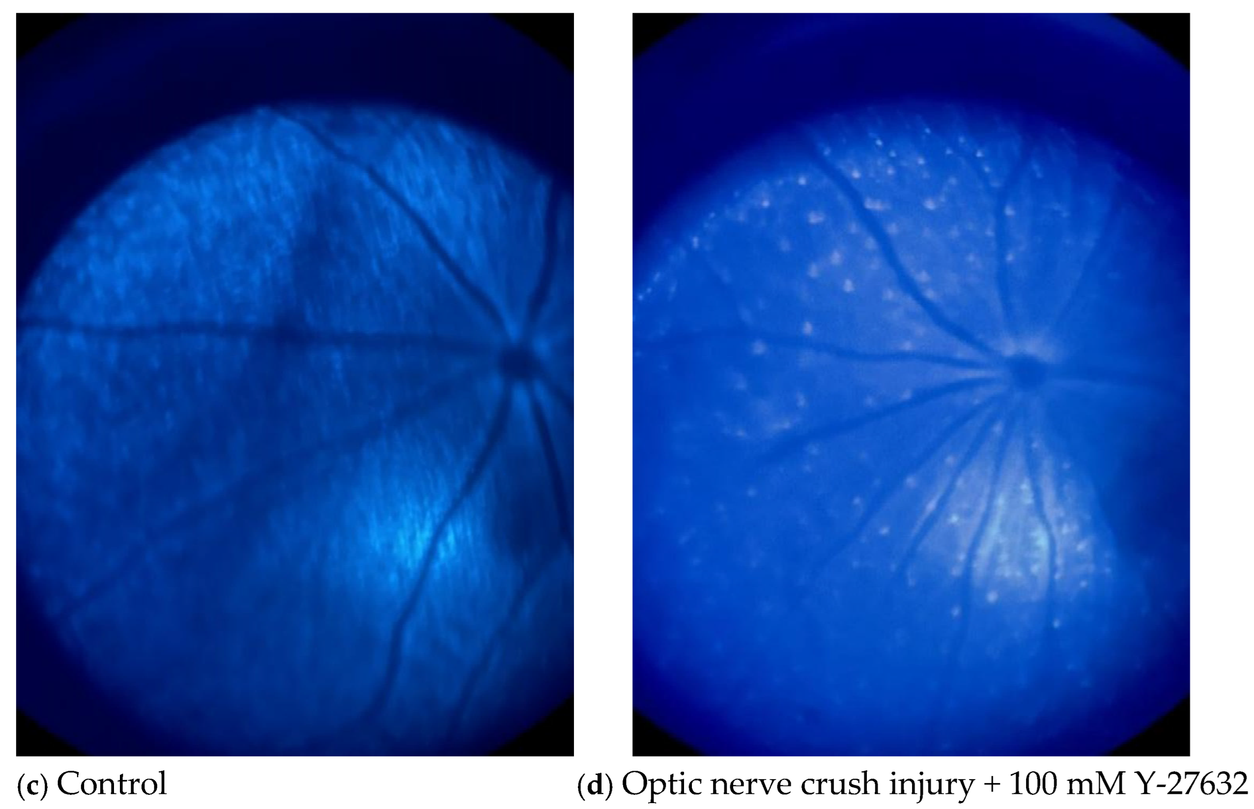 Jcm 14 05344 g005b Jcm 14 05344 g005b