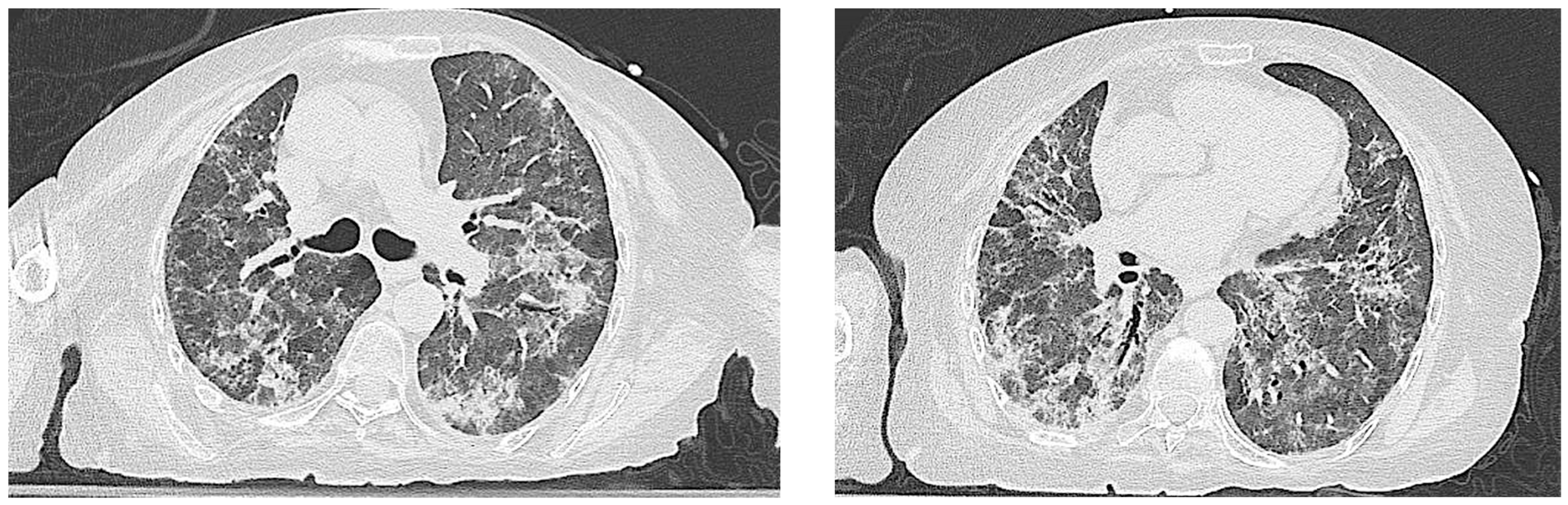 Jcm 14 05395 g003 Jcm 14 05395 g003