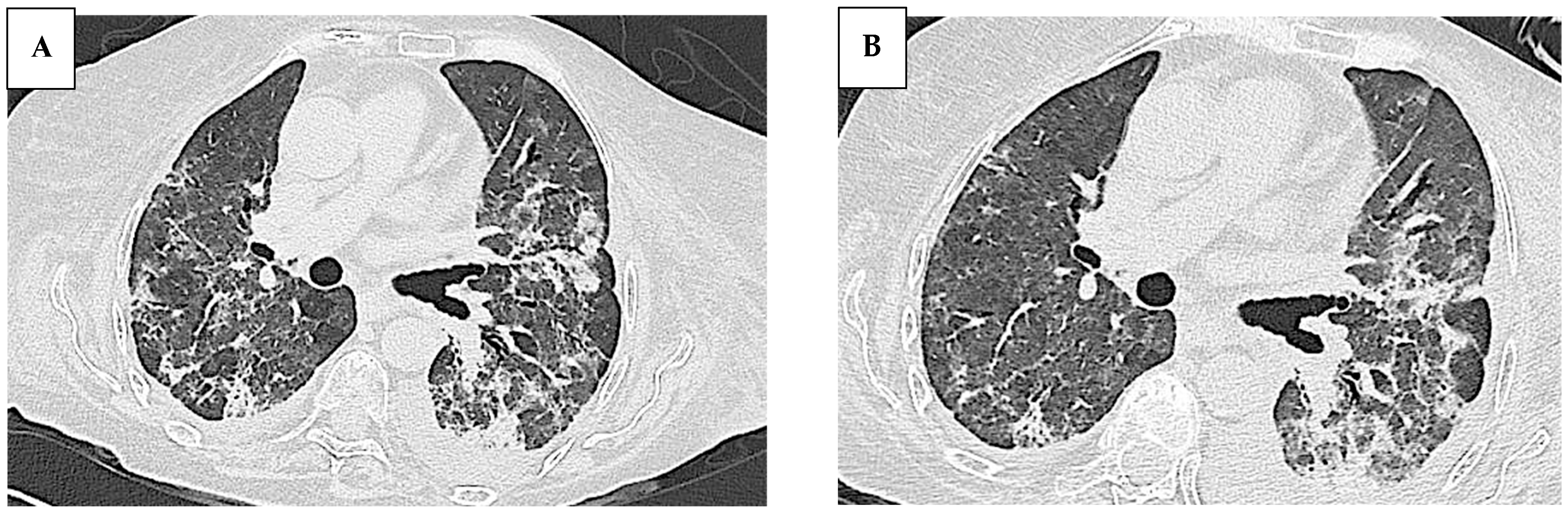 Jcm 14 05395 g005a Jcm 14 05395 g005a