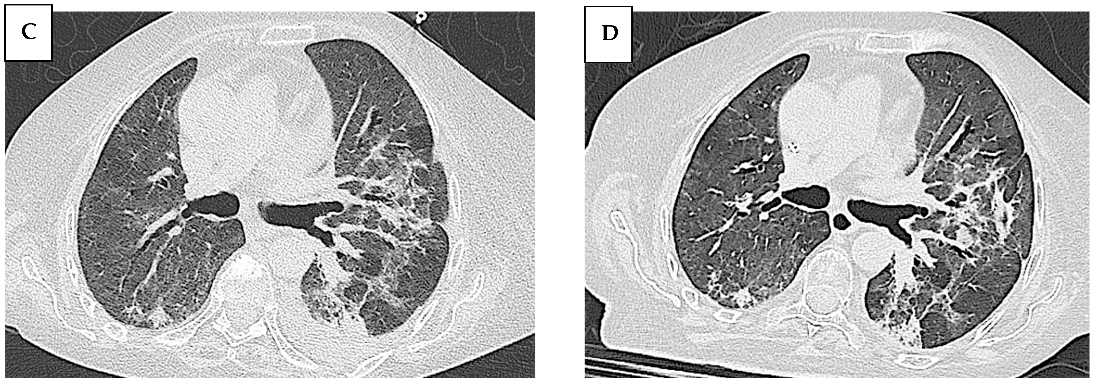 Jcm 14 05395 g005b Jcm 14 05395 g005b