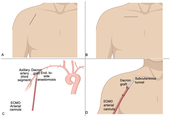 vibration in groin area on left side male Groin Pain Male: 10 Common Causes main image 0