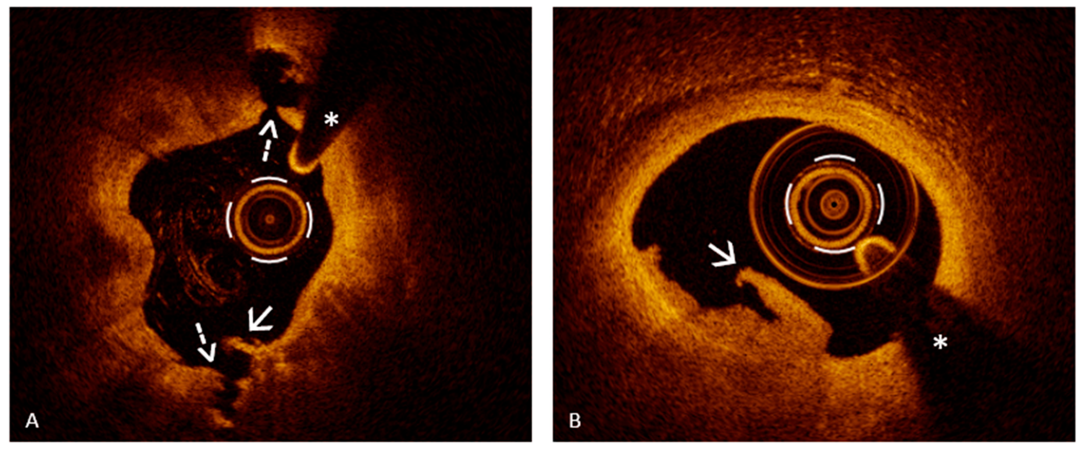 Jcm 14 05456 g001 Jcm 14 05456 g001