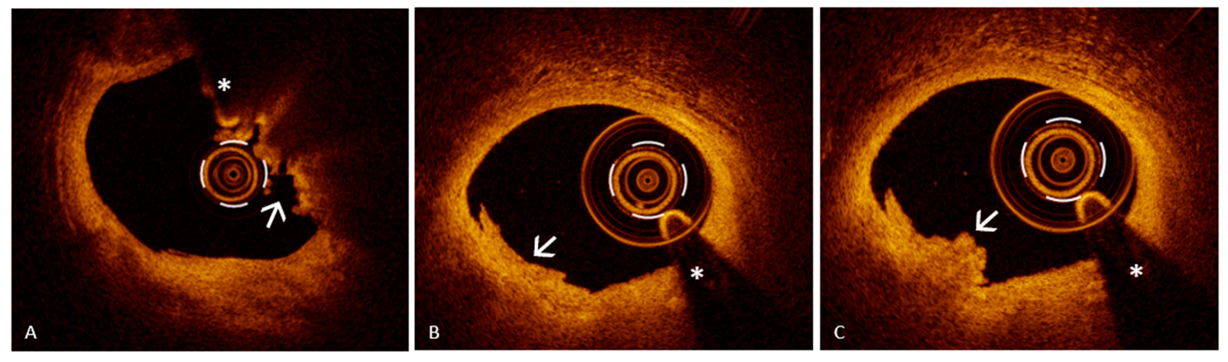 Jcm 14 05456 g002 Jcm 14 05456 g002