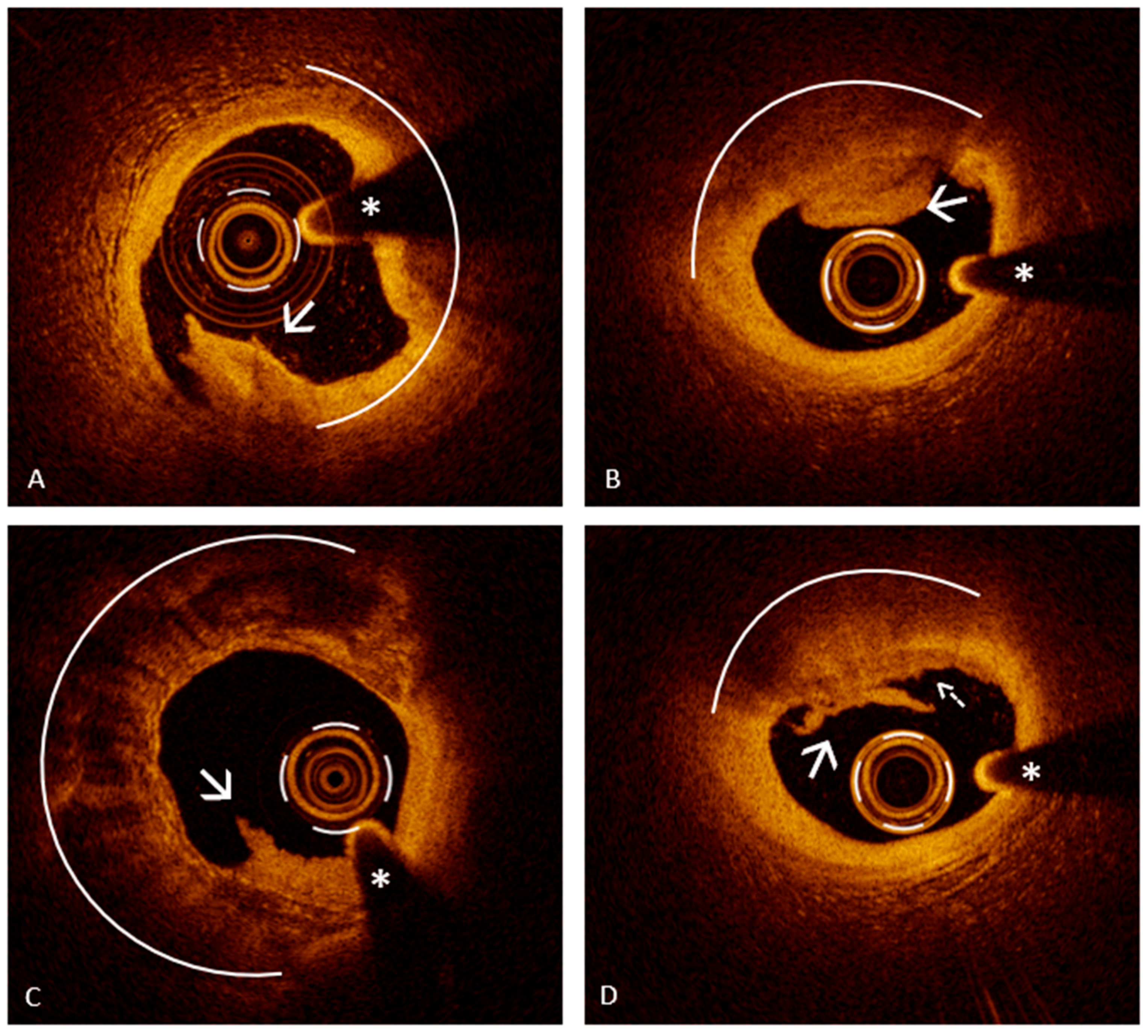 Jcm 14 05456 g003 Jcm 14 05456 g003