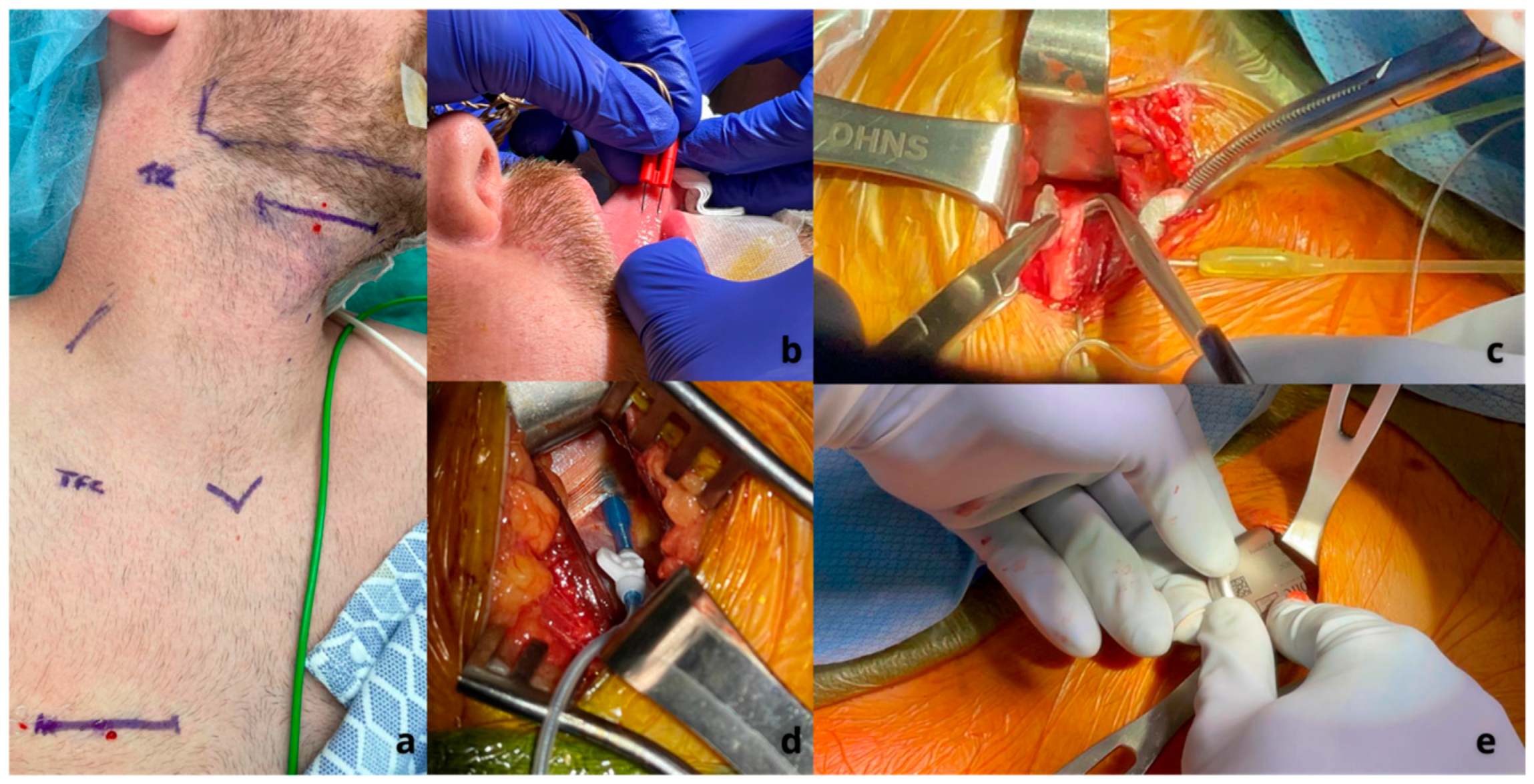 Jcm 14 05494 g003 Jcm 14 05494 g003