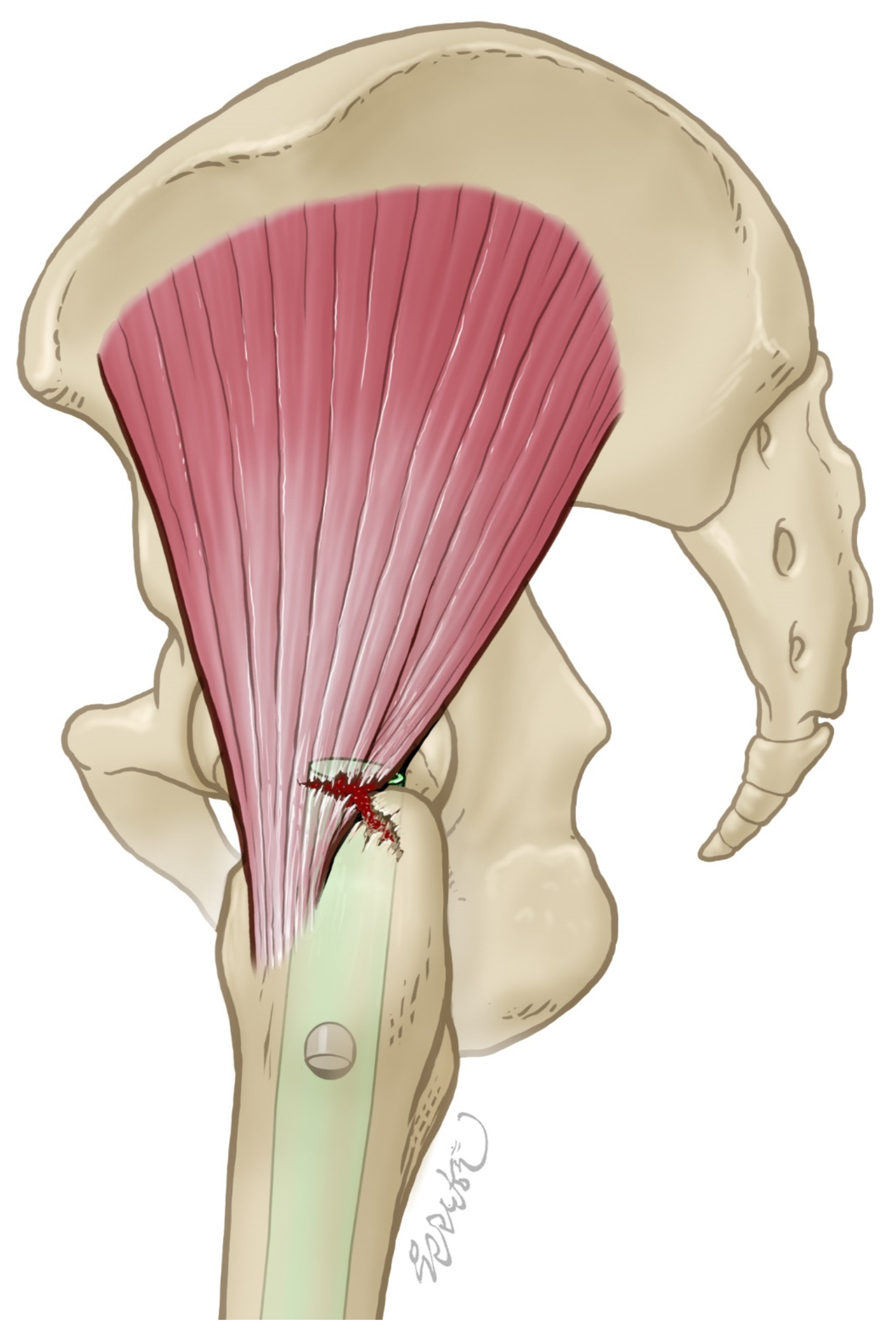 Jcm 14 05498 g001 Jcm 14 05498 g001