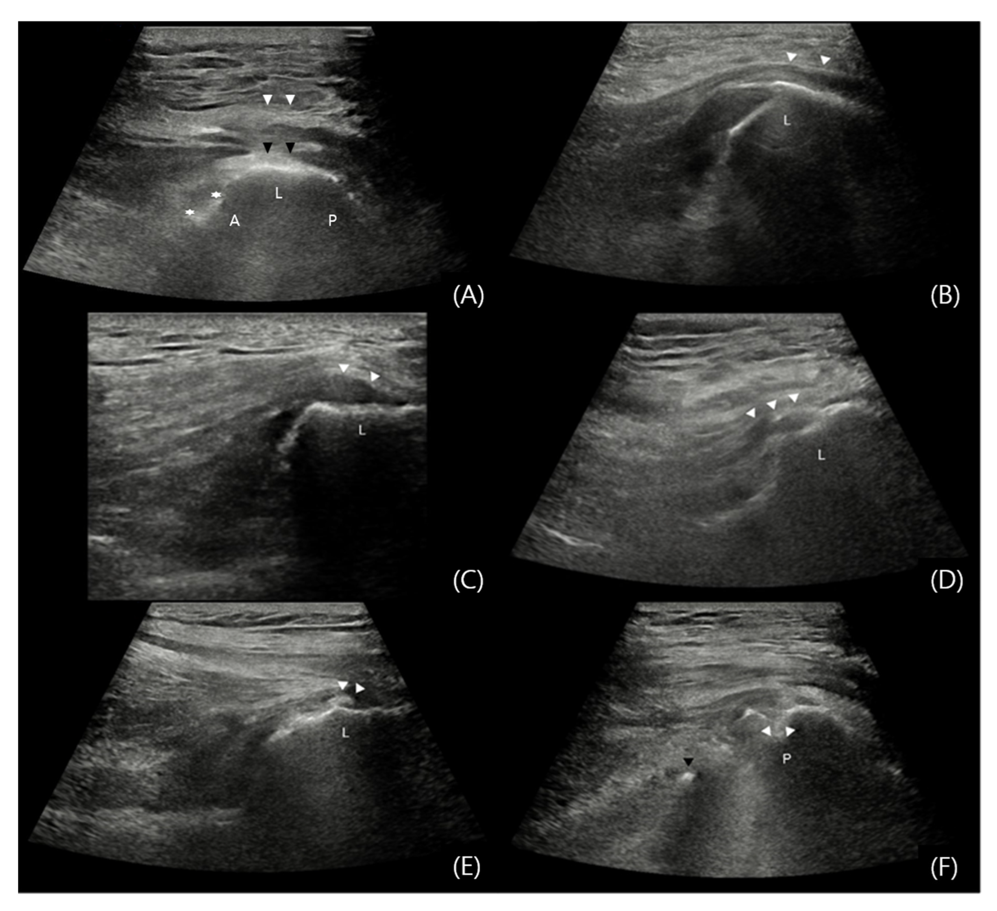 Jcm 14 05498 g004 Jcm 14 05498 g004