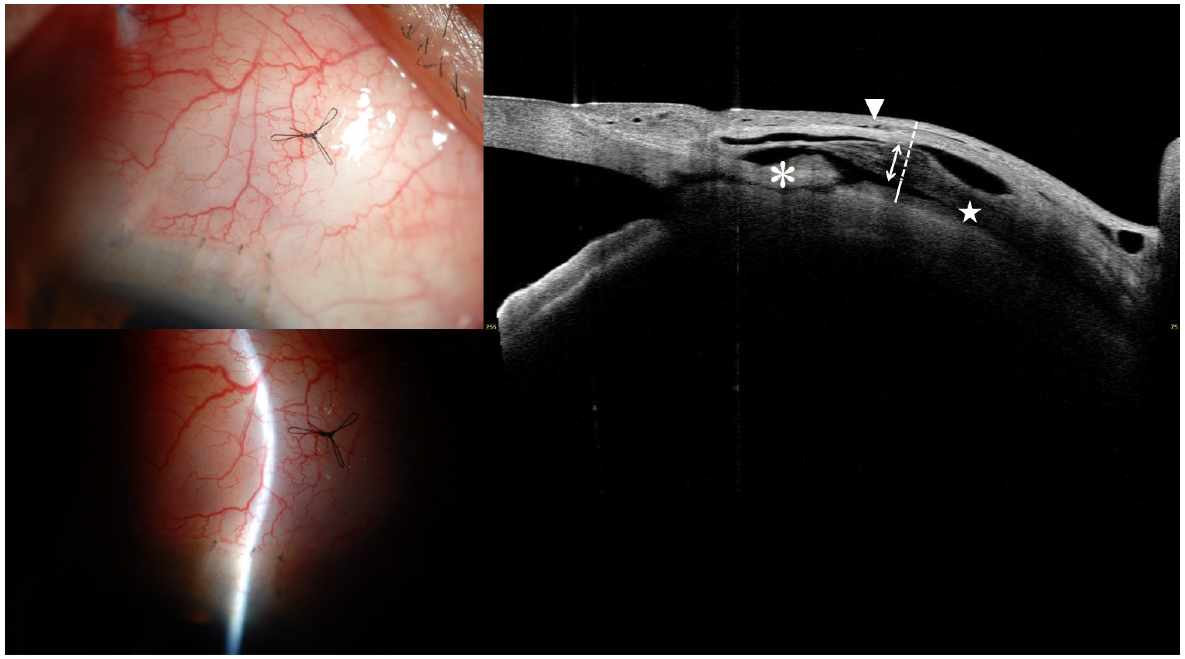 Jcm 14 05499 g001 Jcm 14 05499 g001