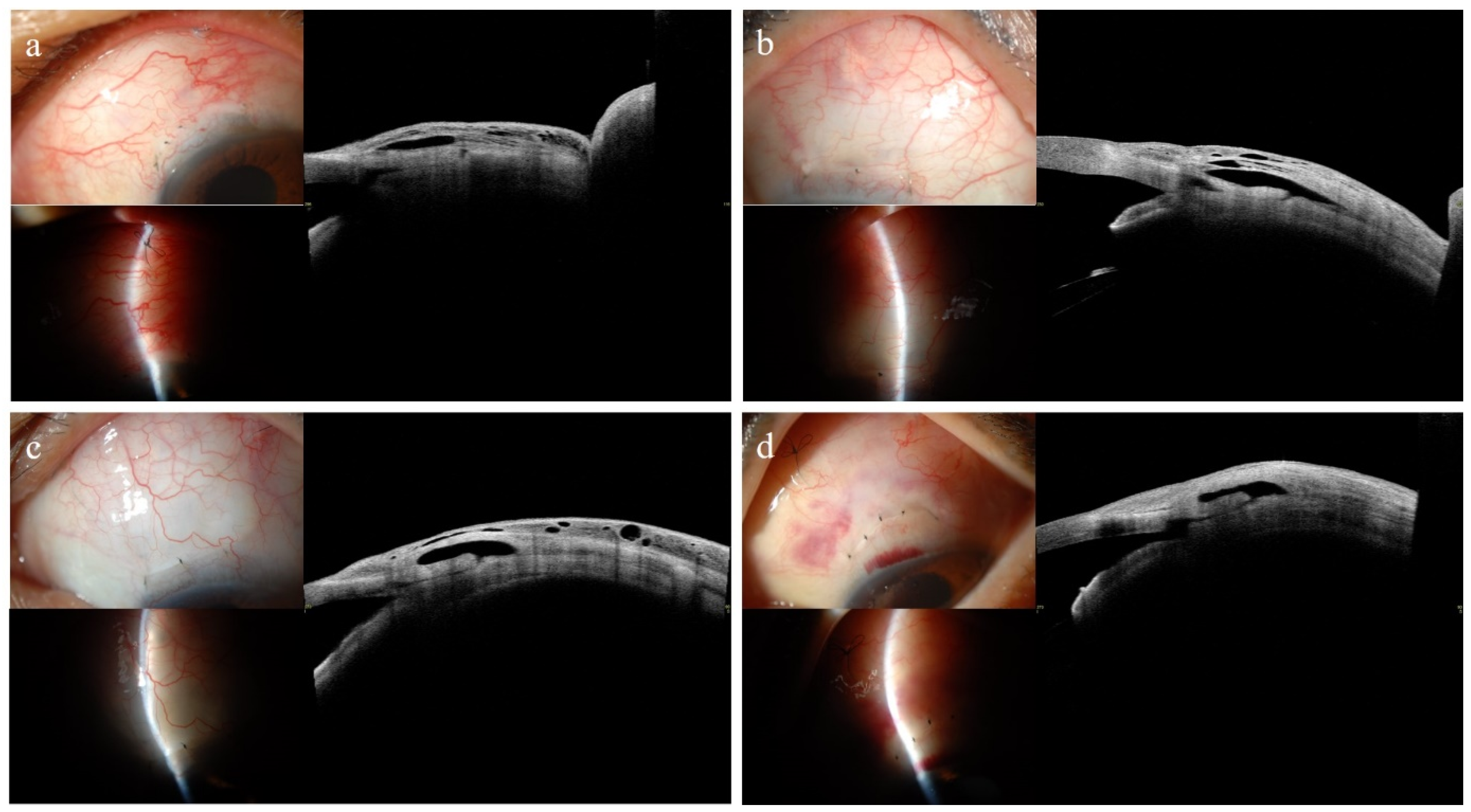 Jcm 14 05499 g003 Jcm 14 05499 g003