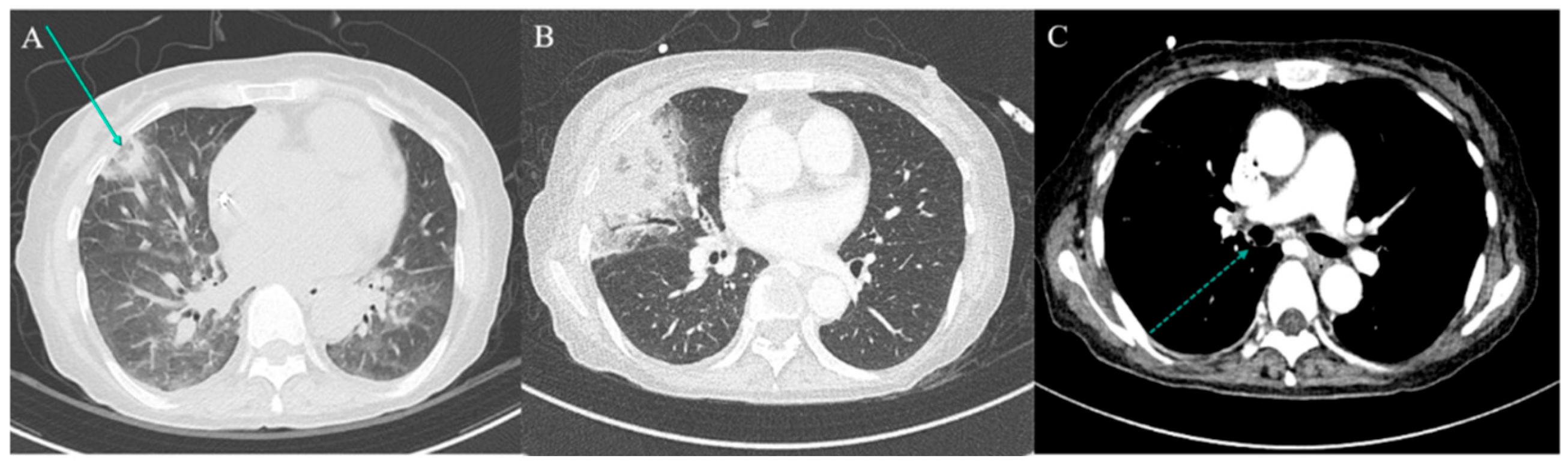 Jcm 14 05526 g001 Jcm 14 05526 g001