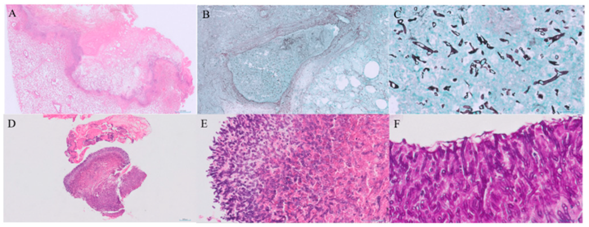 Jcm 14 05526 g003 Jcm 14 05526 g003