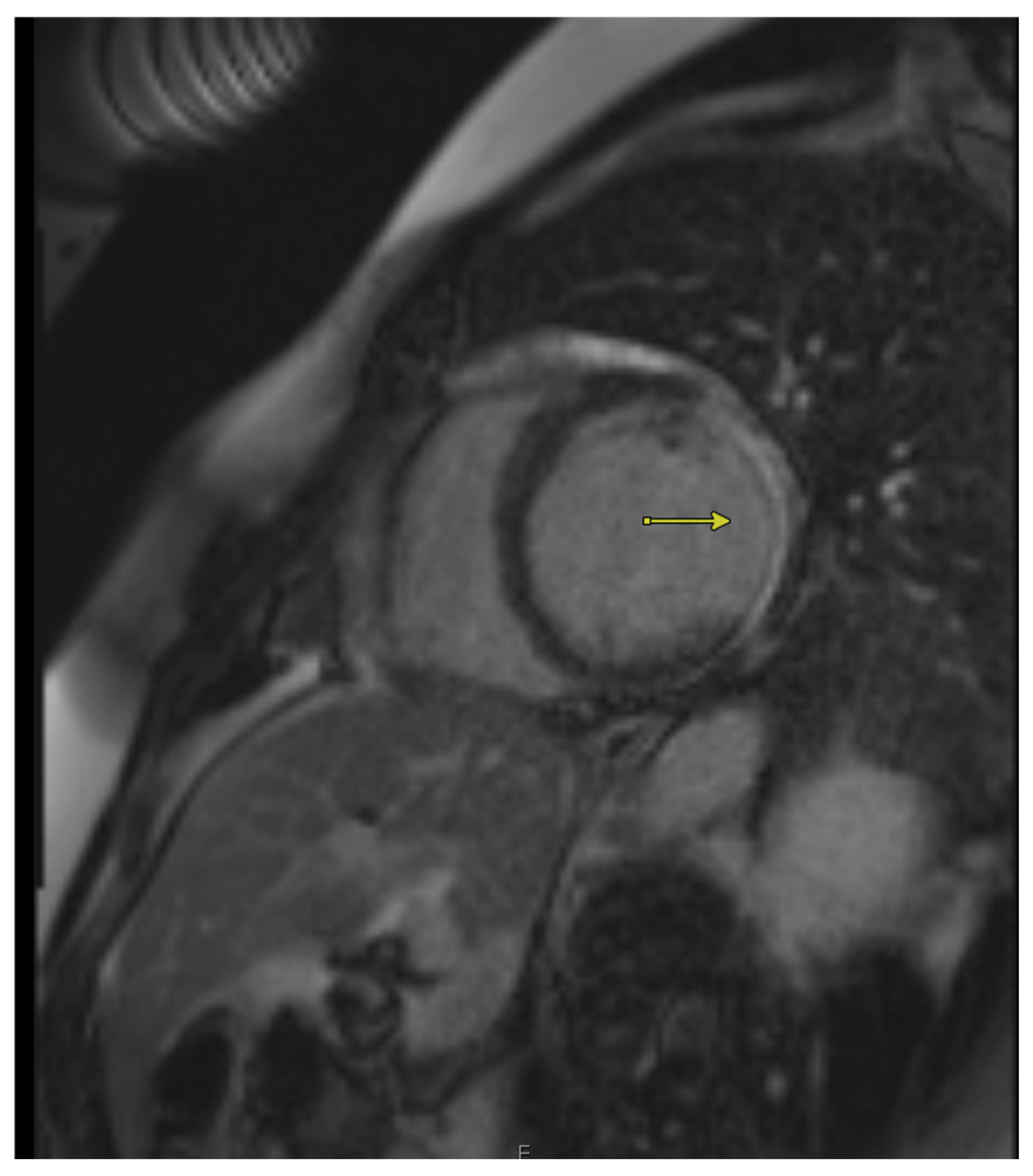 Jcm 14 05529 g001 Jcm 14 05529 g001