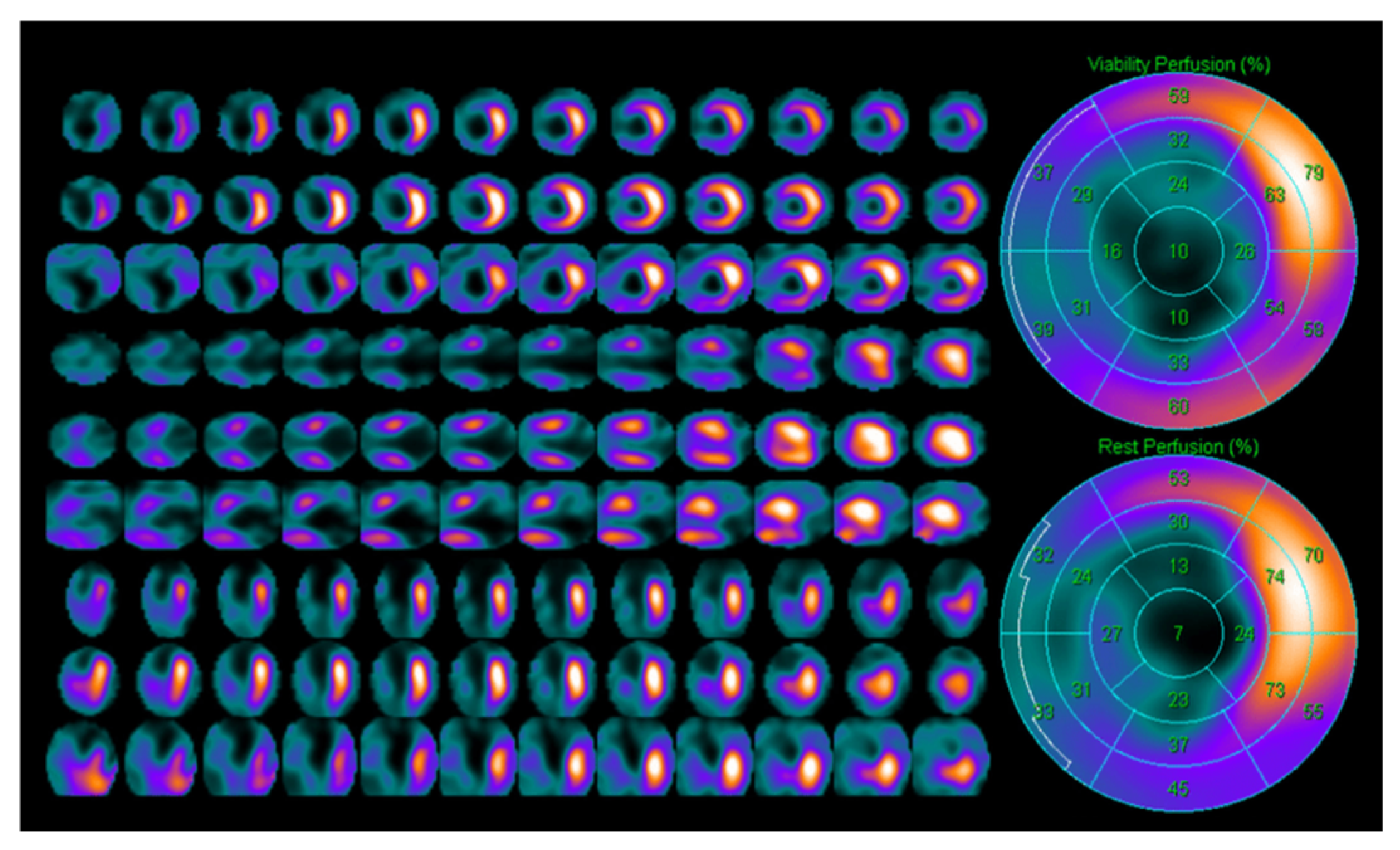 Jcm 14 05529 g003 Jcm 14 05529 g003