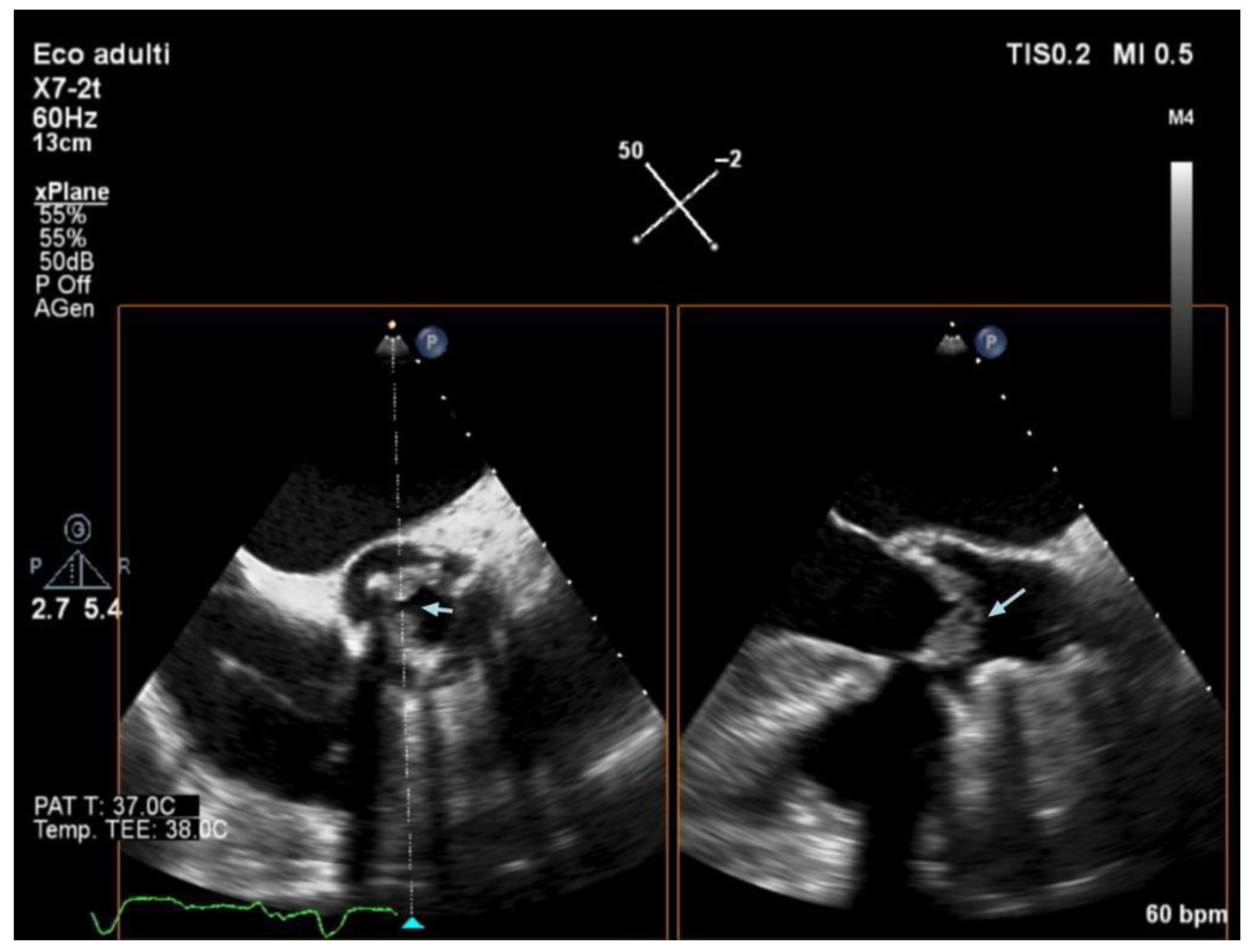 Jcm 14 05589 g002 Jcm 14 05589 g002