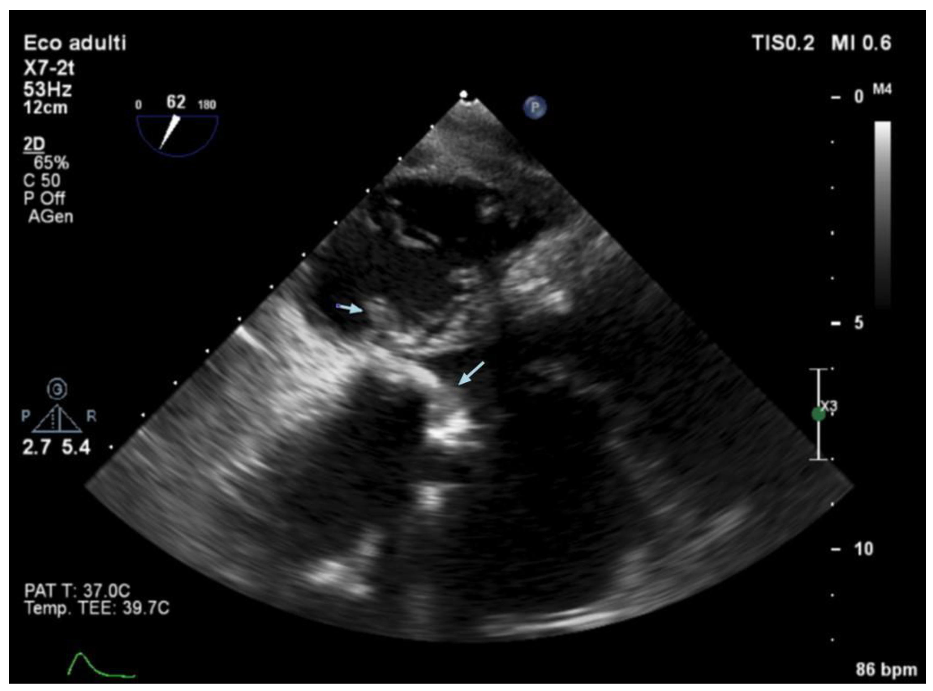 Jcm 14 05589 g003 Jcm 14 05589 g003