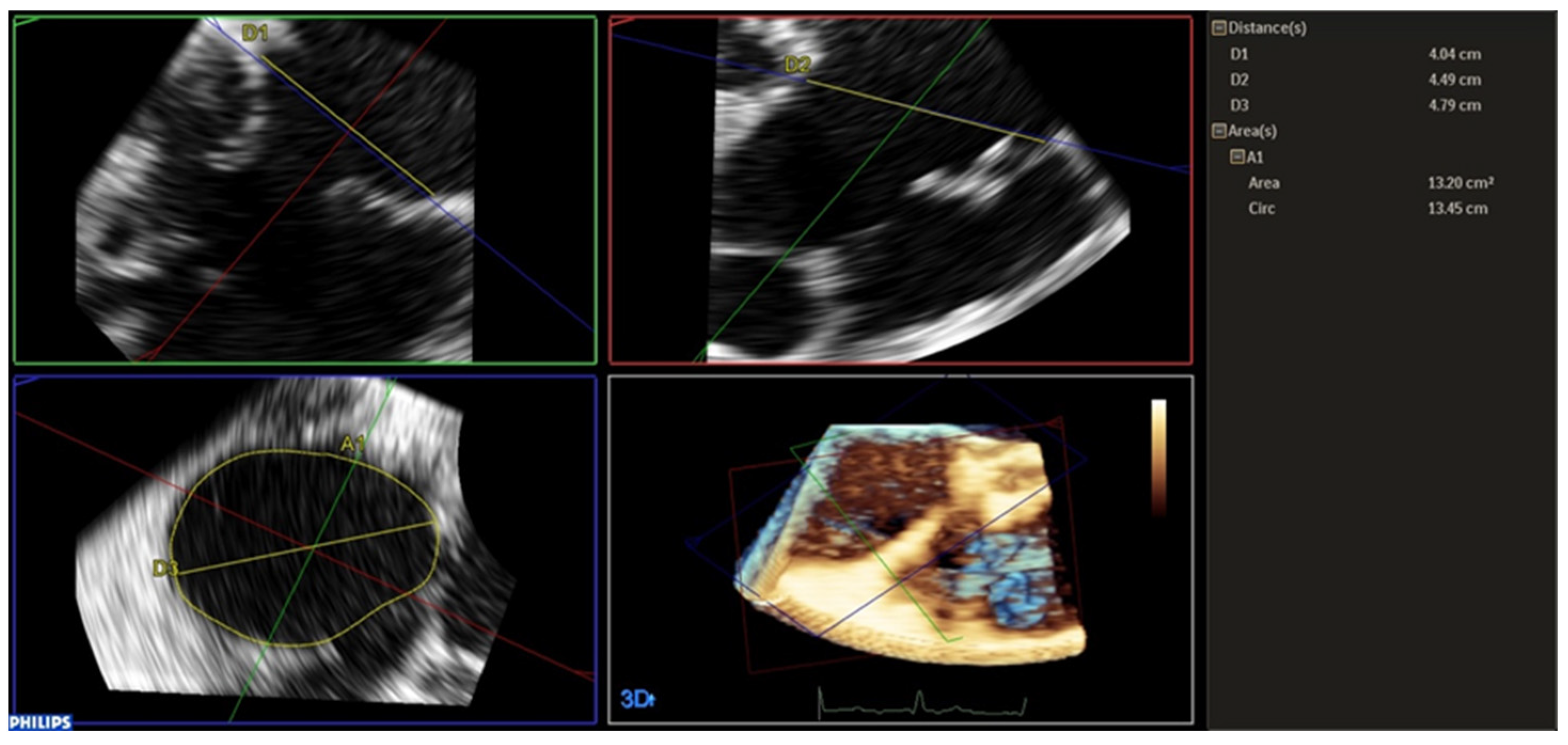Jcm 14 05606 g001 Jcm 14 05606 g001