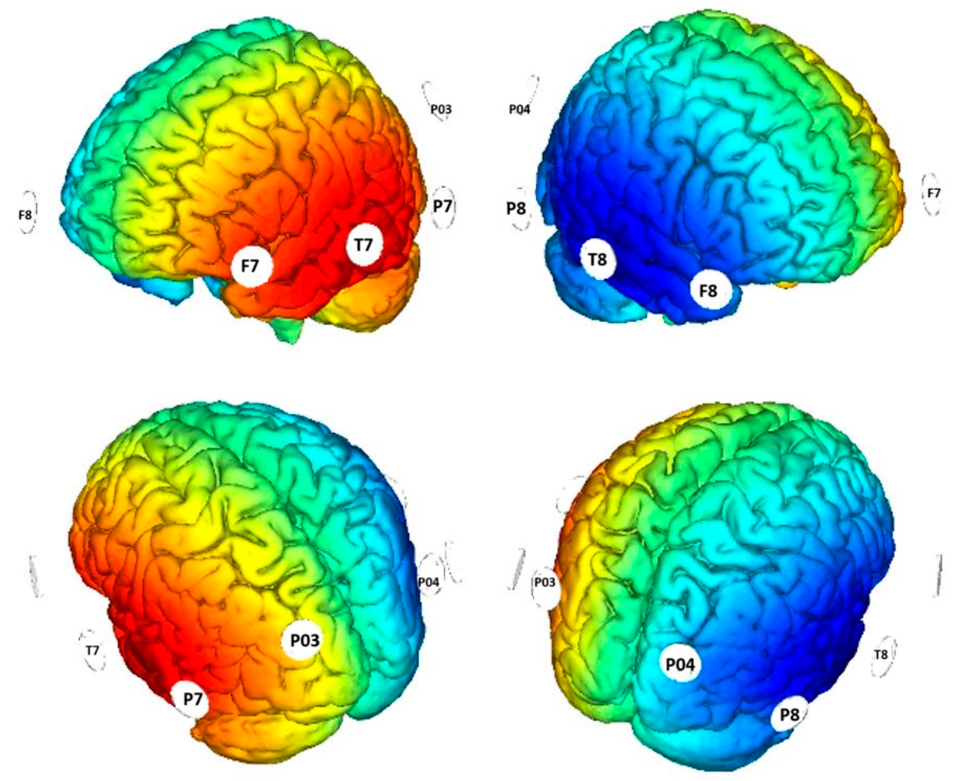 Jcm 14 05671 g001 Jcm 14 05671 g001