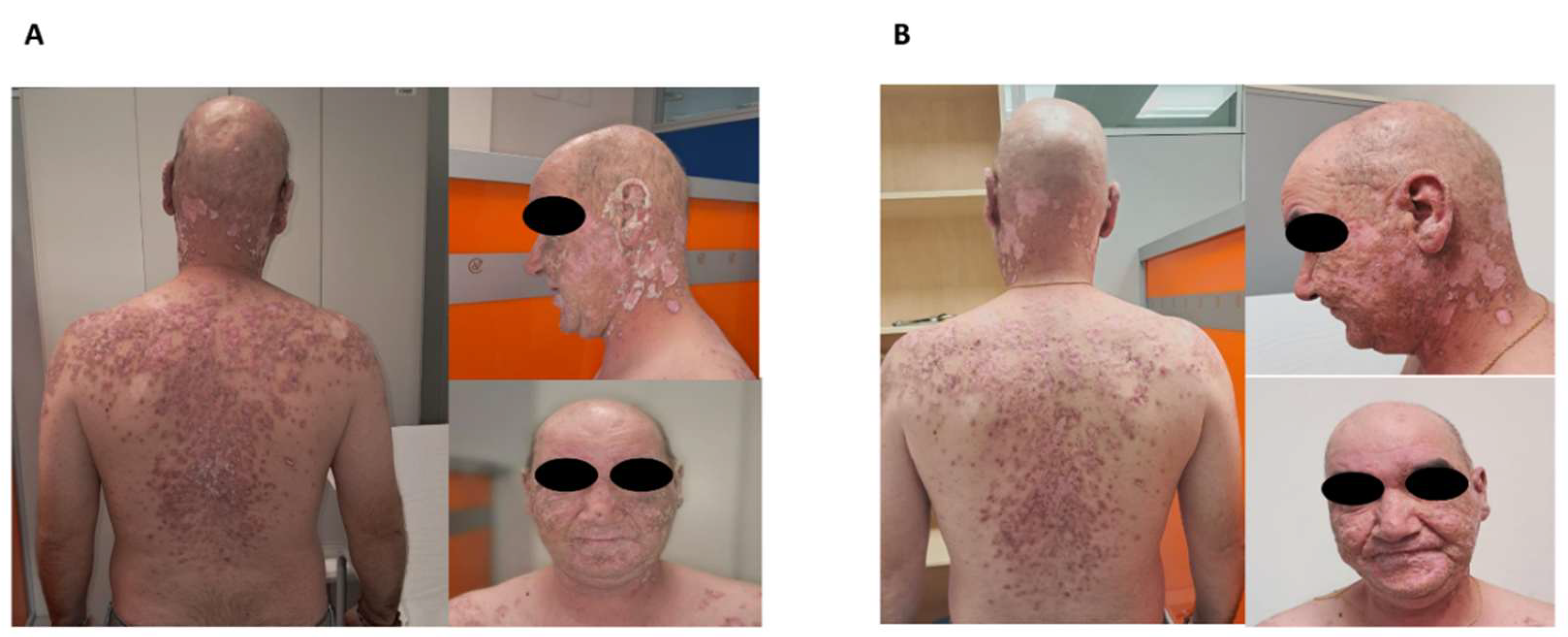 Jcm 14 05683 g001 Jcm 14 05683 g001