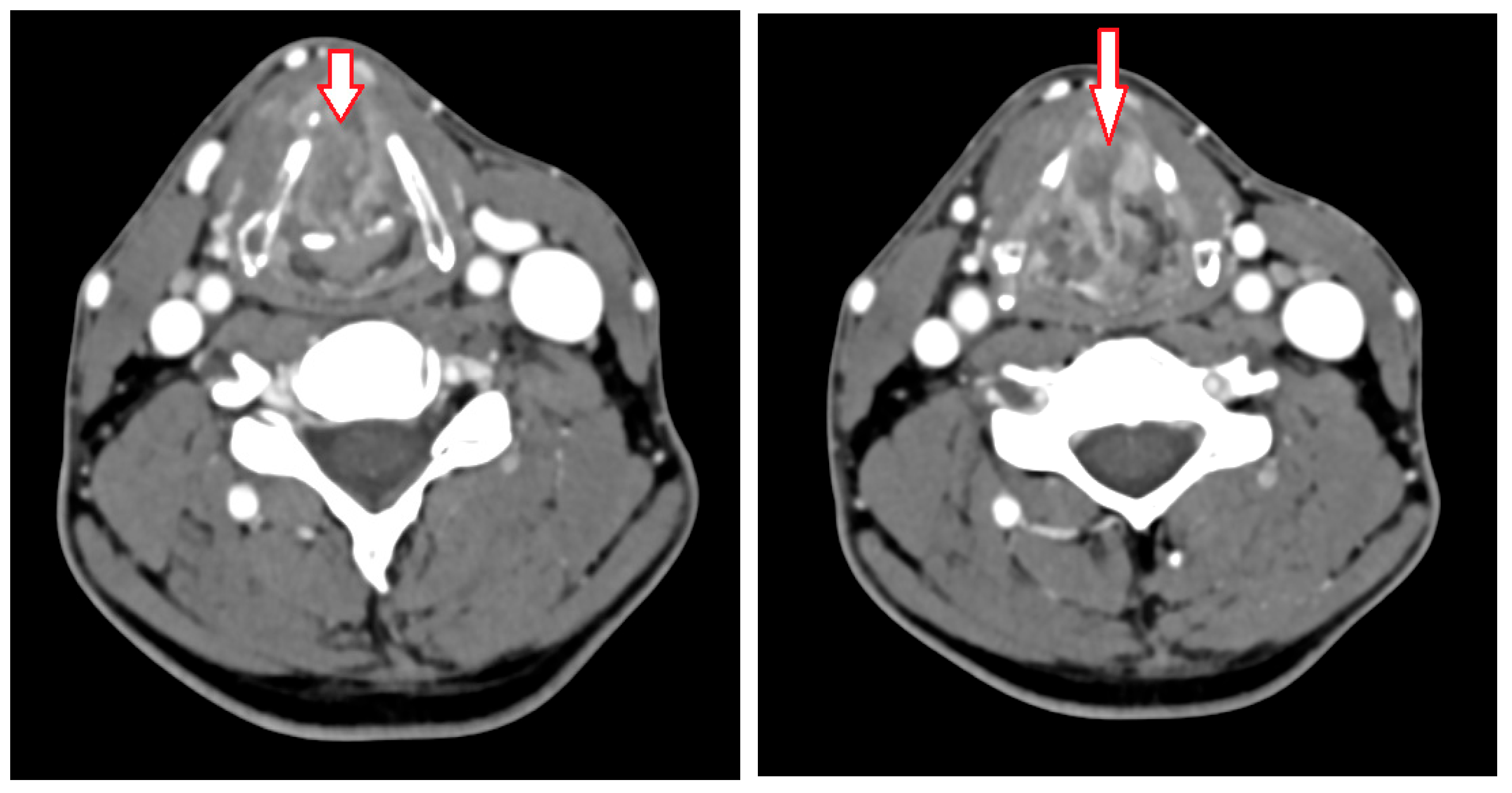 Jcm 14 05694 g001 Jcm 14 05694 g001