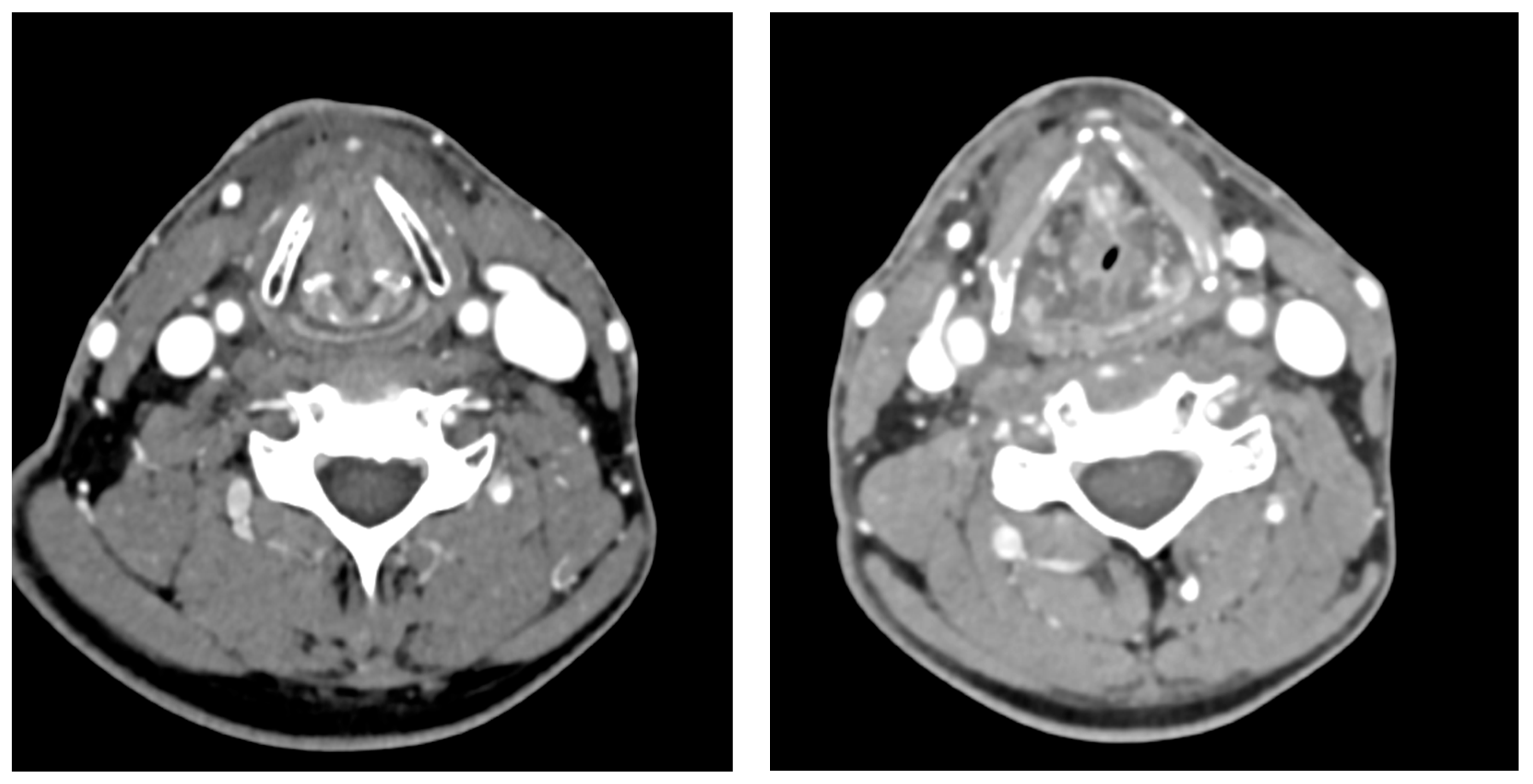 Jcm 14 05694 g003 Jcm 14 05694 g003