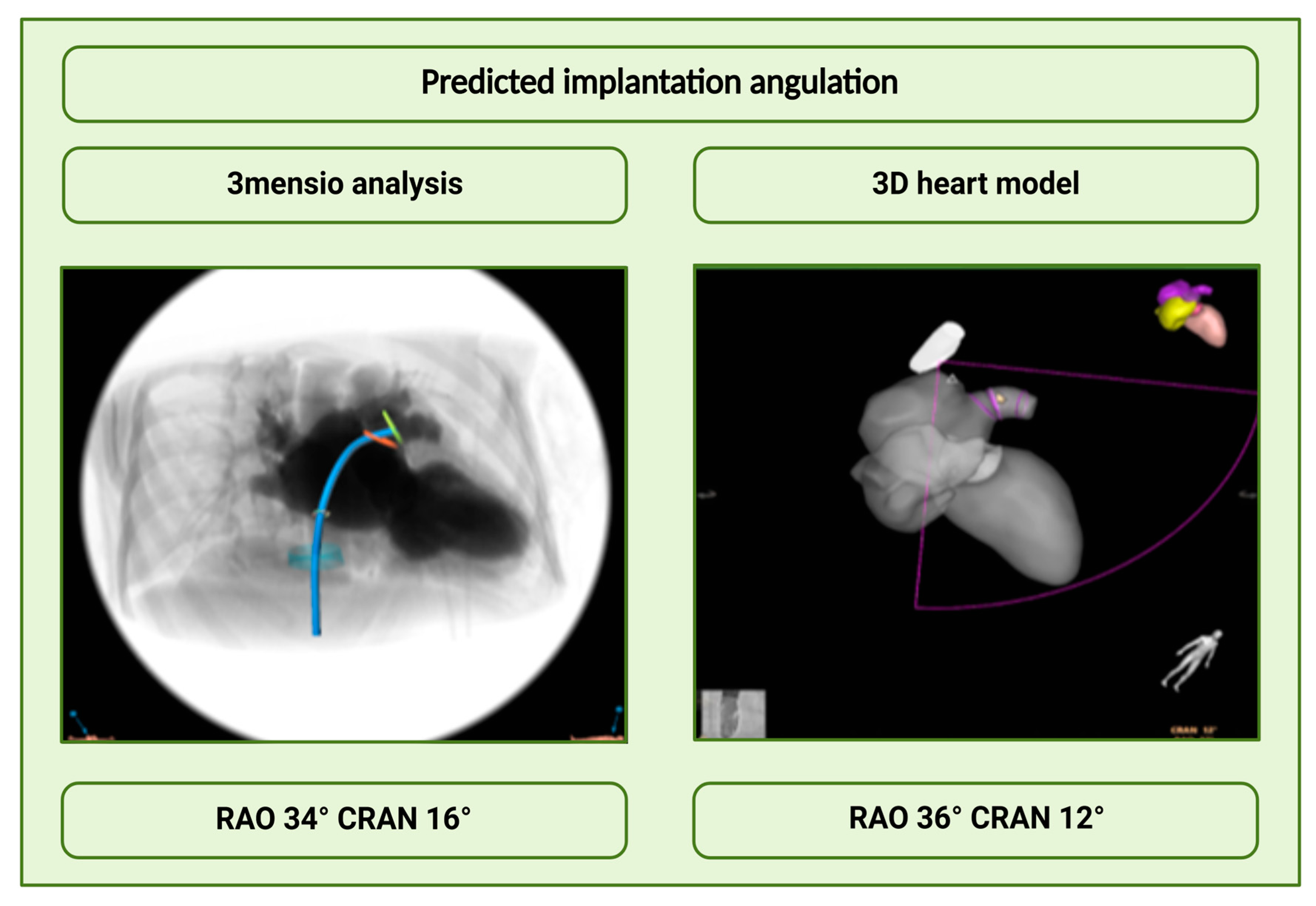 Jcm 14 05696 g005 Jcm 14 05696 g005