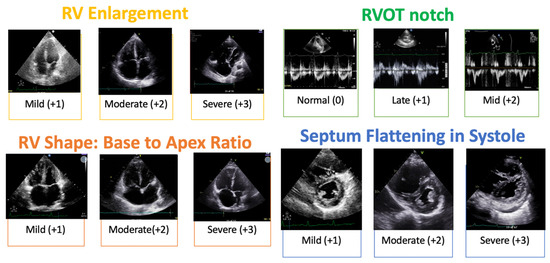洋楽 APEX CREW Top Notch G RAP rare 洋楽 APEX CREW Top Notch G RAP rare ◎5/18(土) GANGSTA RAP