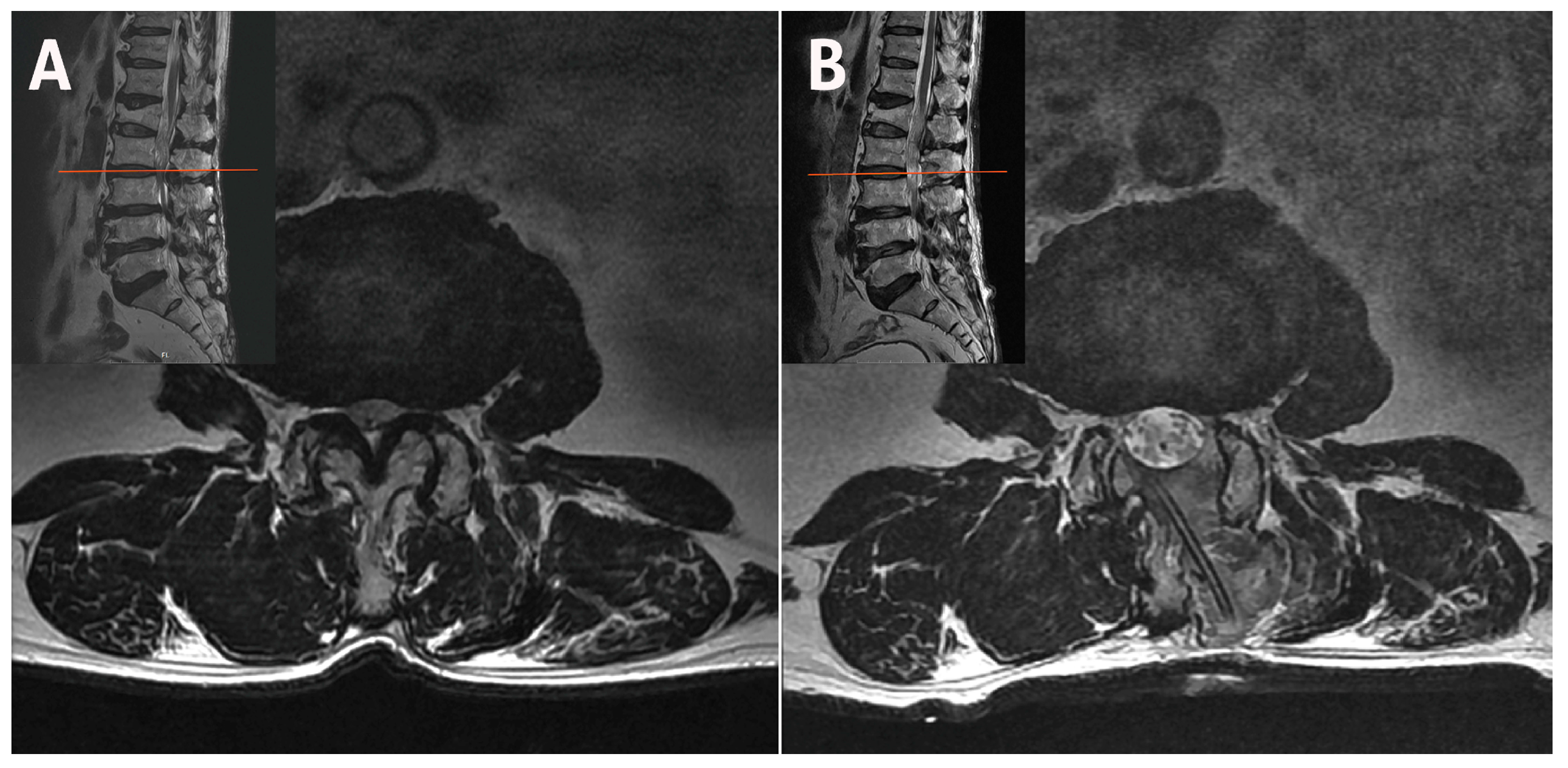 Jcm 14 05726 g002 Jcm 14 05726 g002