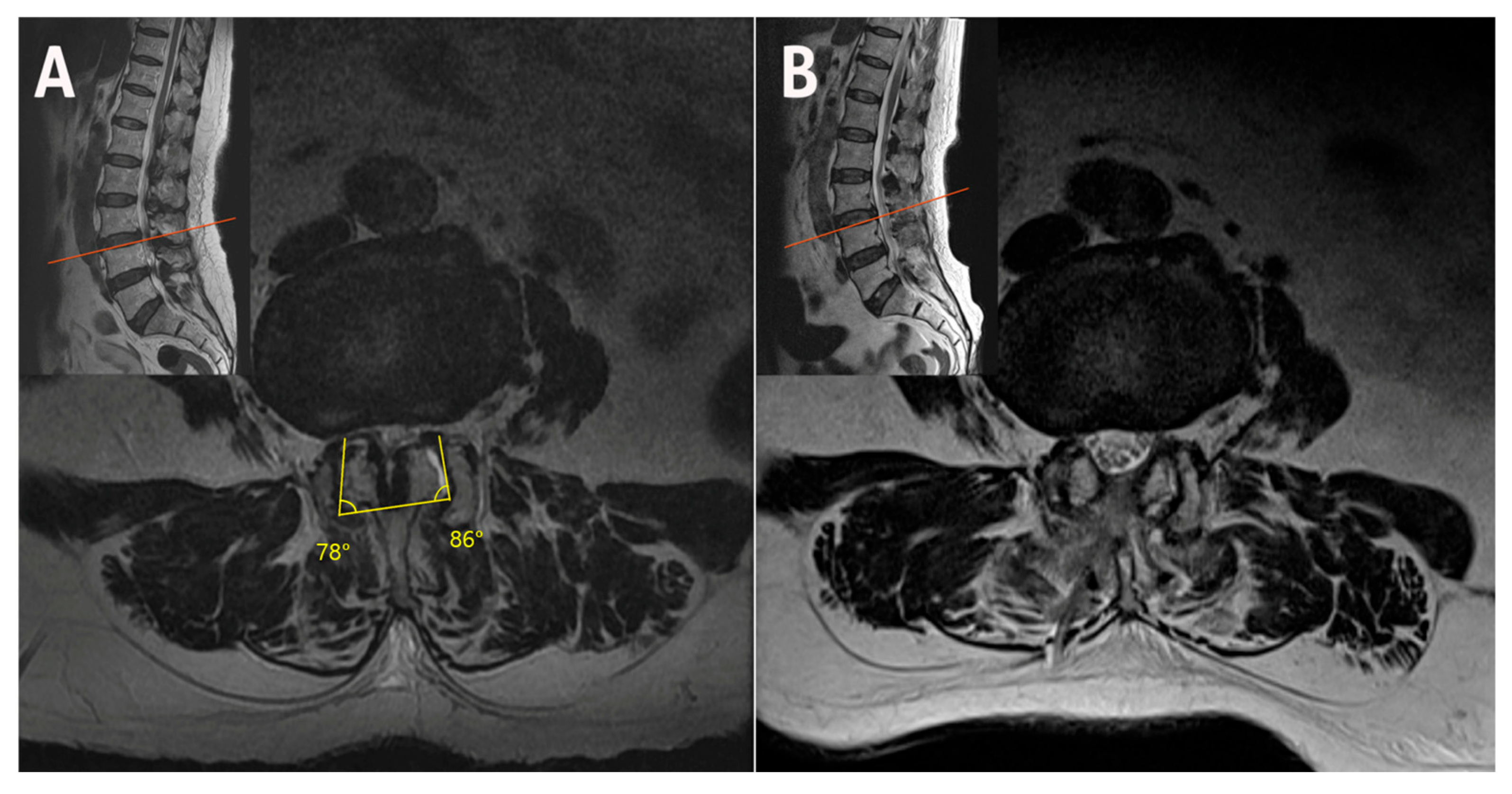 Jcm 14 05726 g006 Jcm 14 05726 g006
