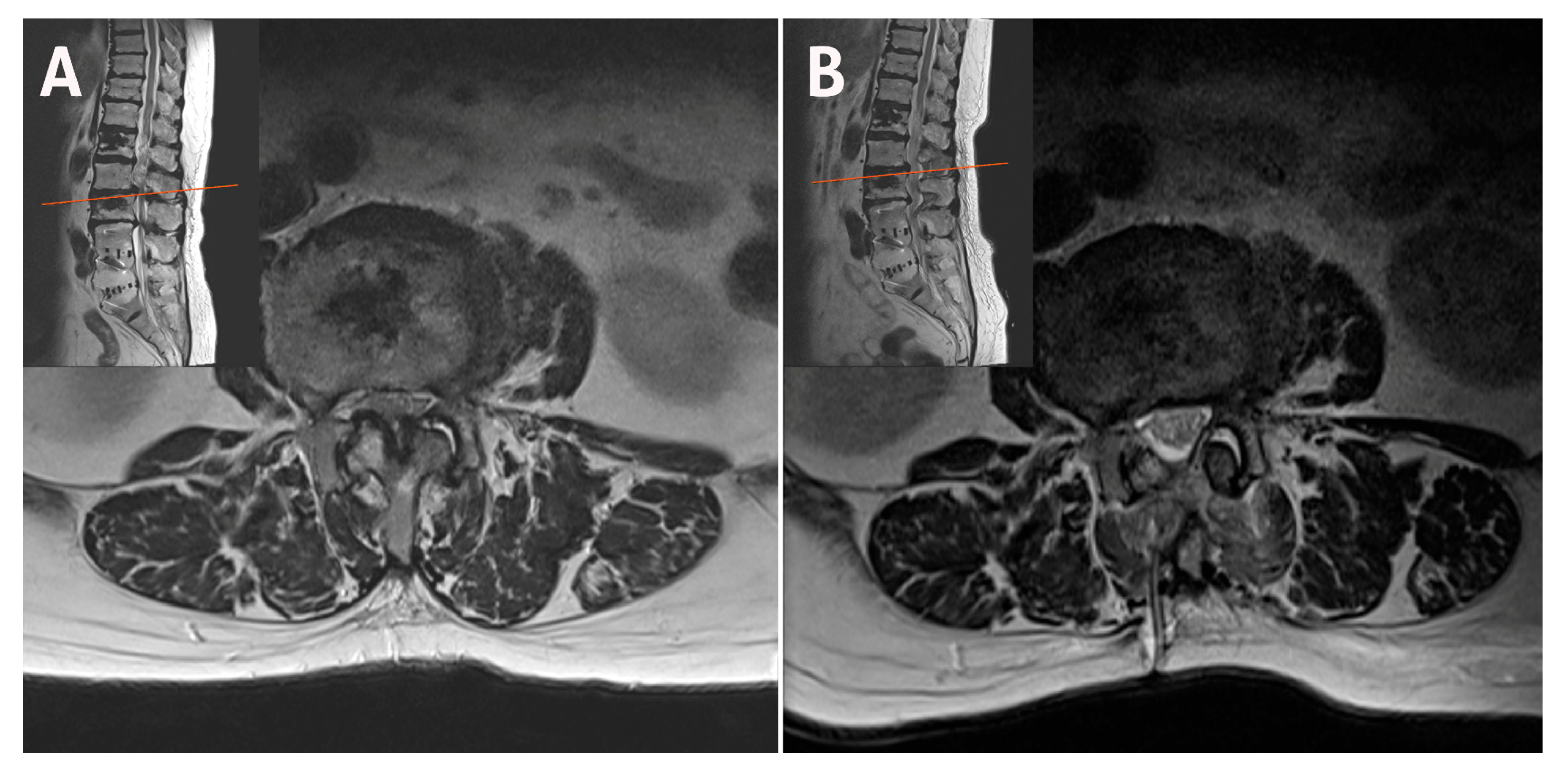 Jcm 14 05726 g007 Jcm 14 05726 g007