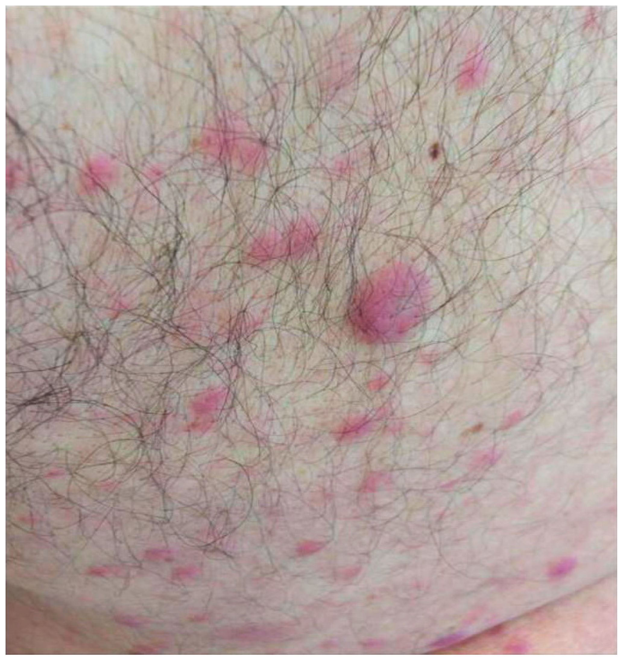 Jcm 14 05743 g001 Jcm 14 05743 g001