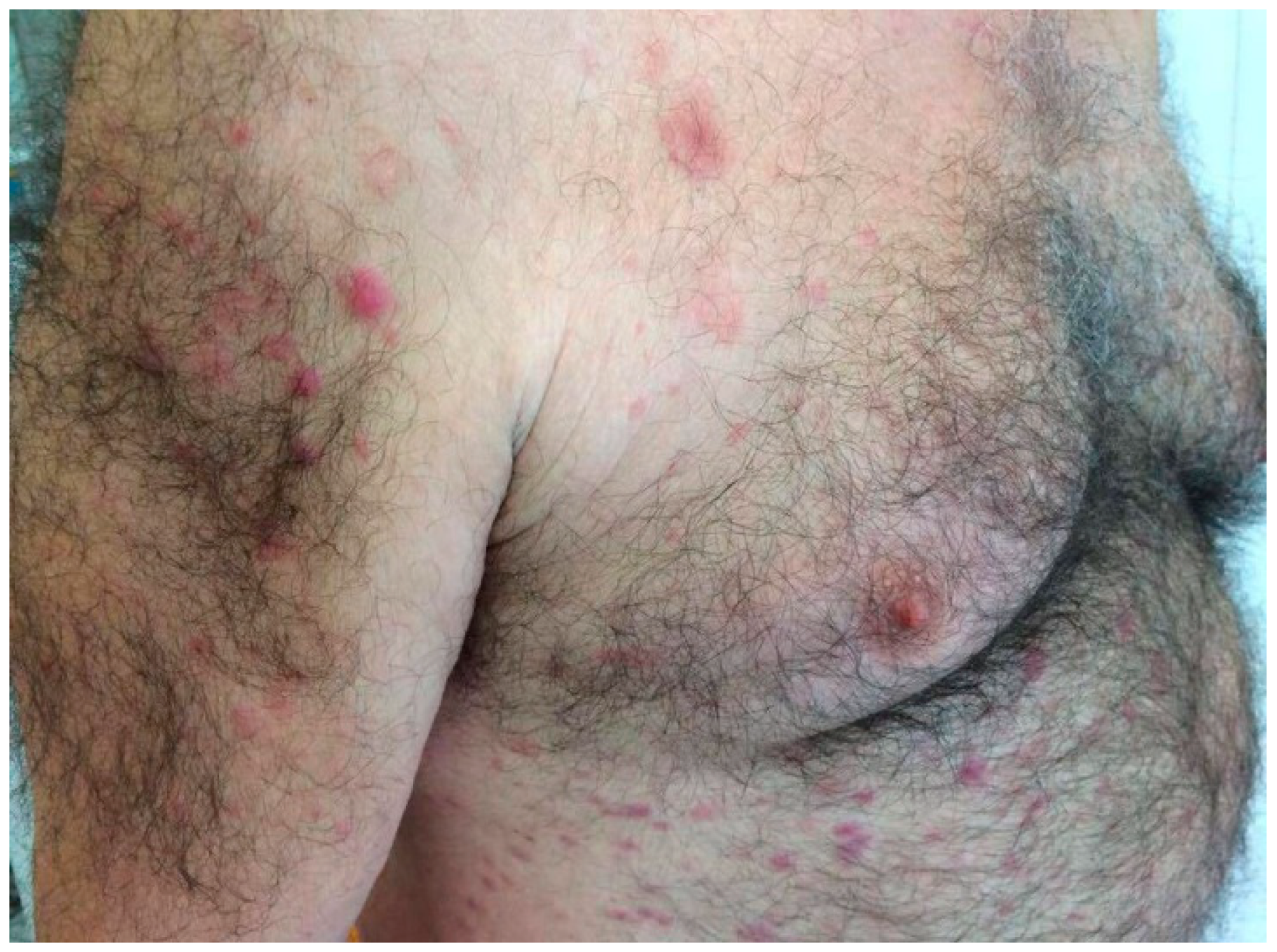 Jcm 14 05743 g002 Jcm 14 05743 g002