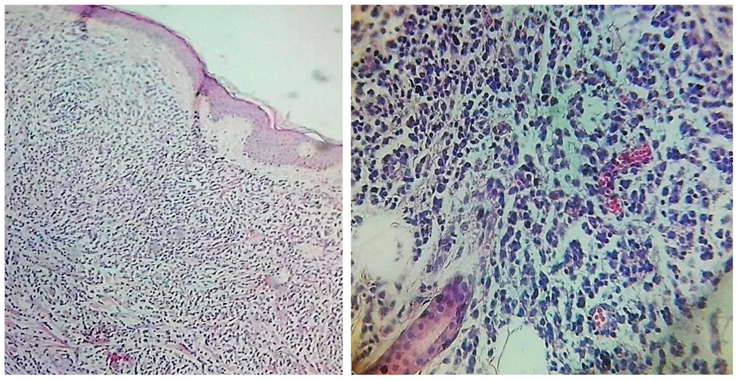 Jcm 14 05743 g003 Jcm 14 05743 g003