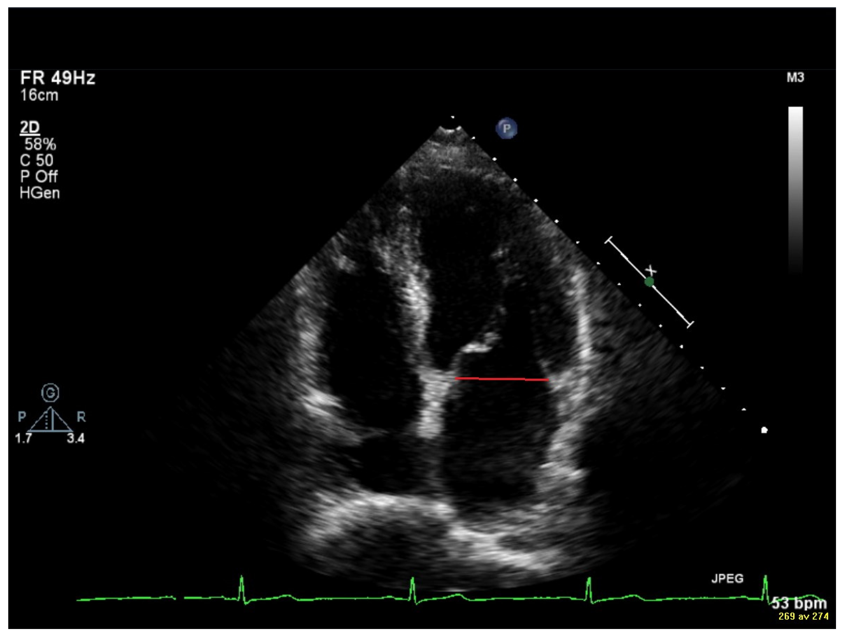Jcm 14 05783 g001 Jcm 14 05783 g001