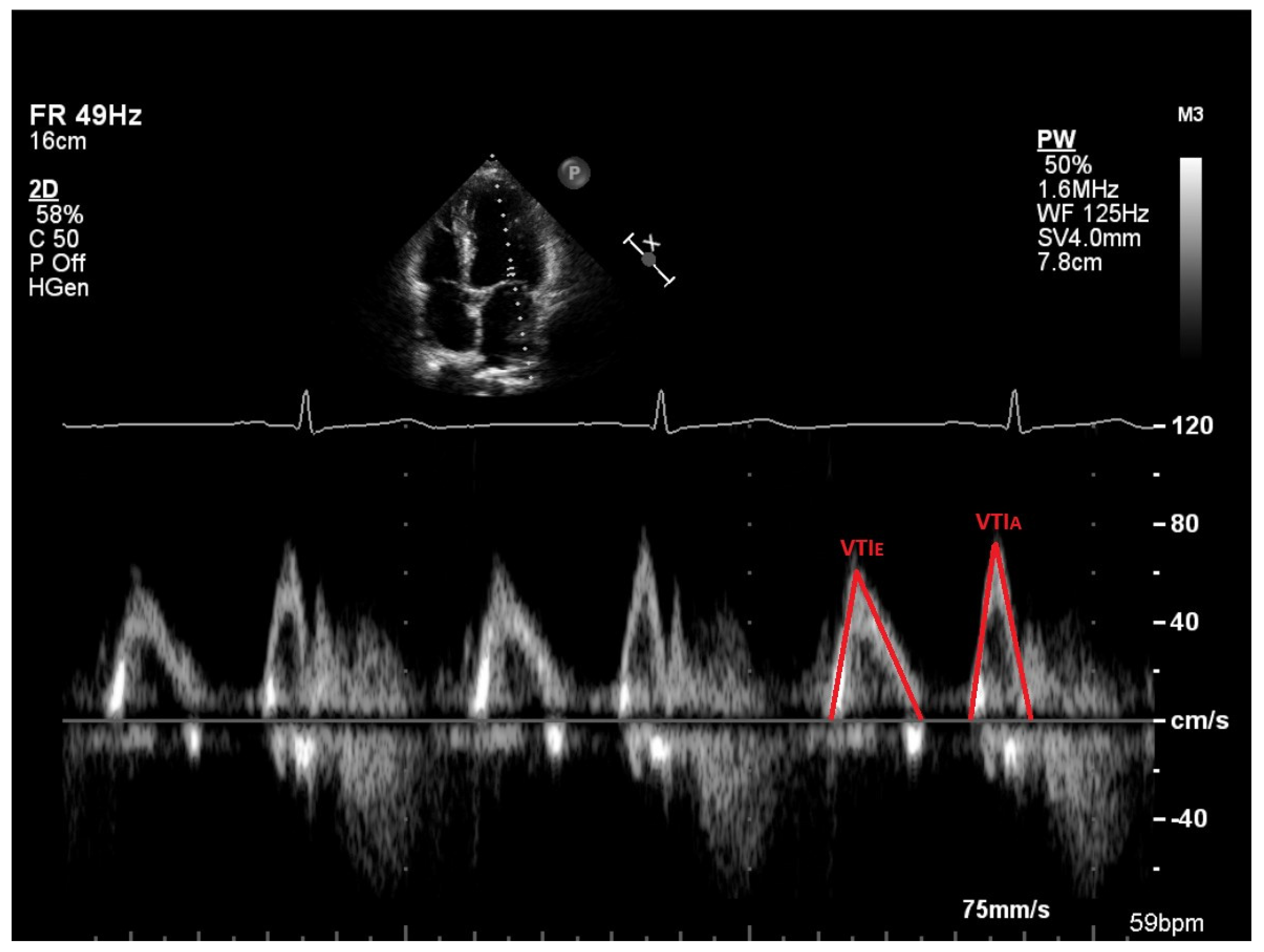 Jcm 14 05783 g002 Jcm 14 05783 g002