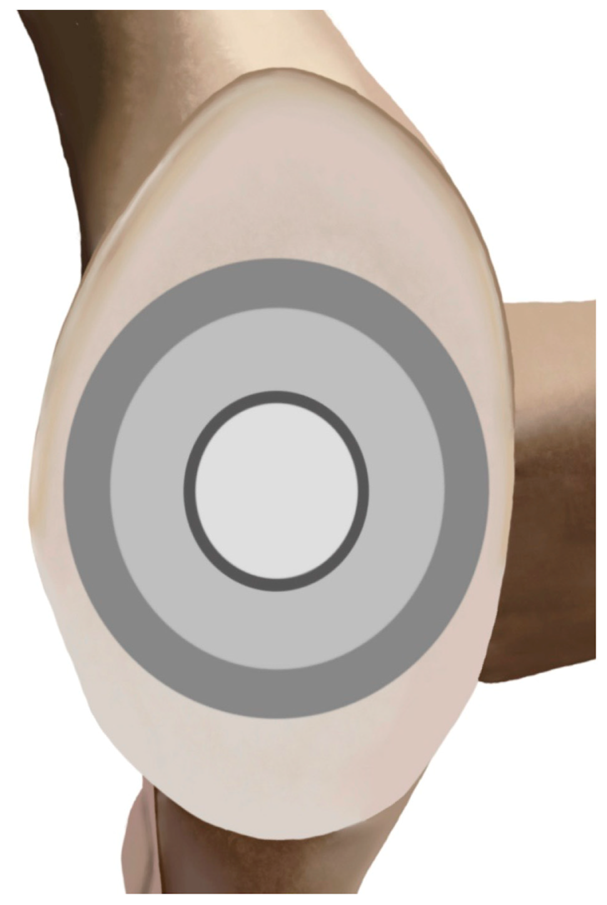 Jcm 14 05820 g002 Jcm 14 05820 g002