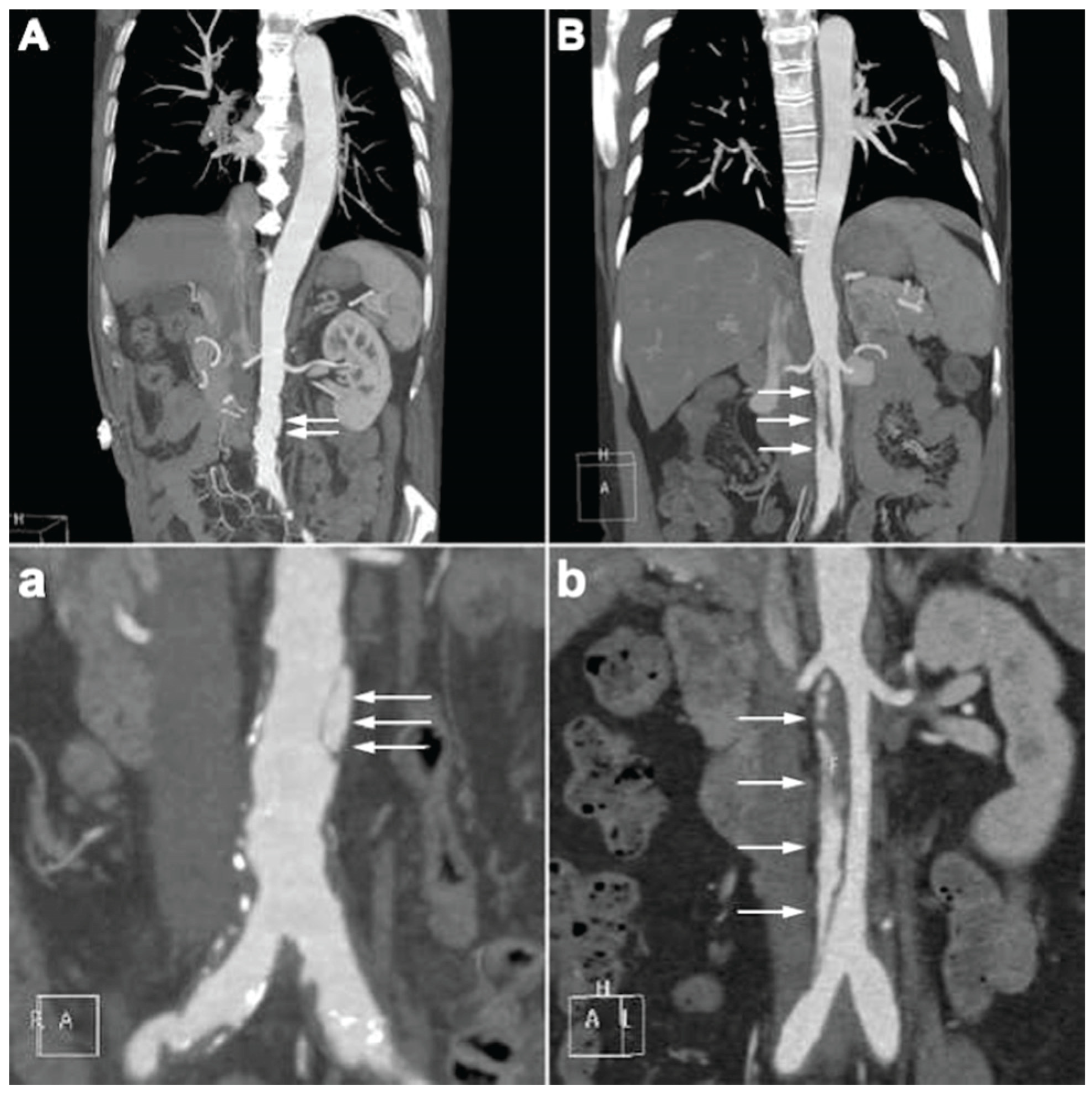 Jcm 14 05849 g002 Jcm 14 05849 g002