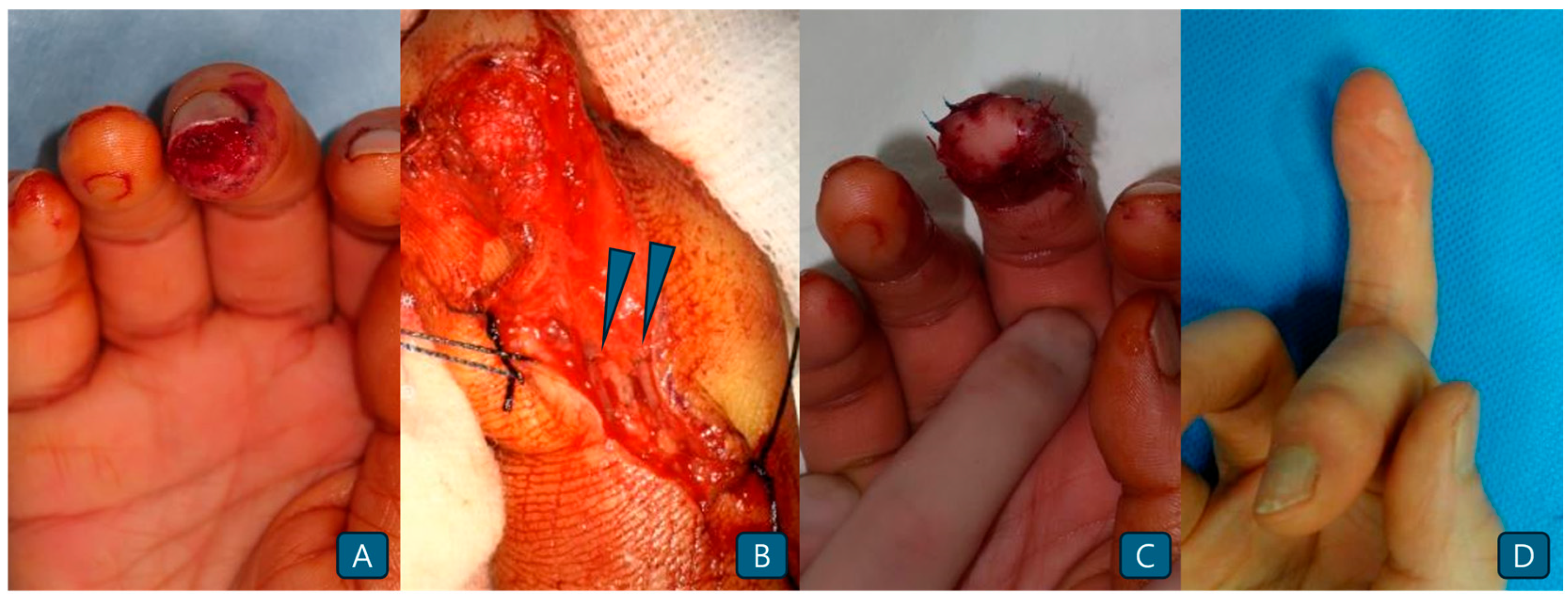 Jcm 14 05855 g003 Jcm 14 05855 g003