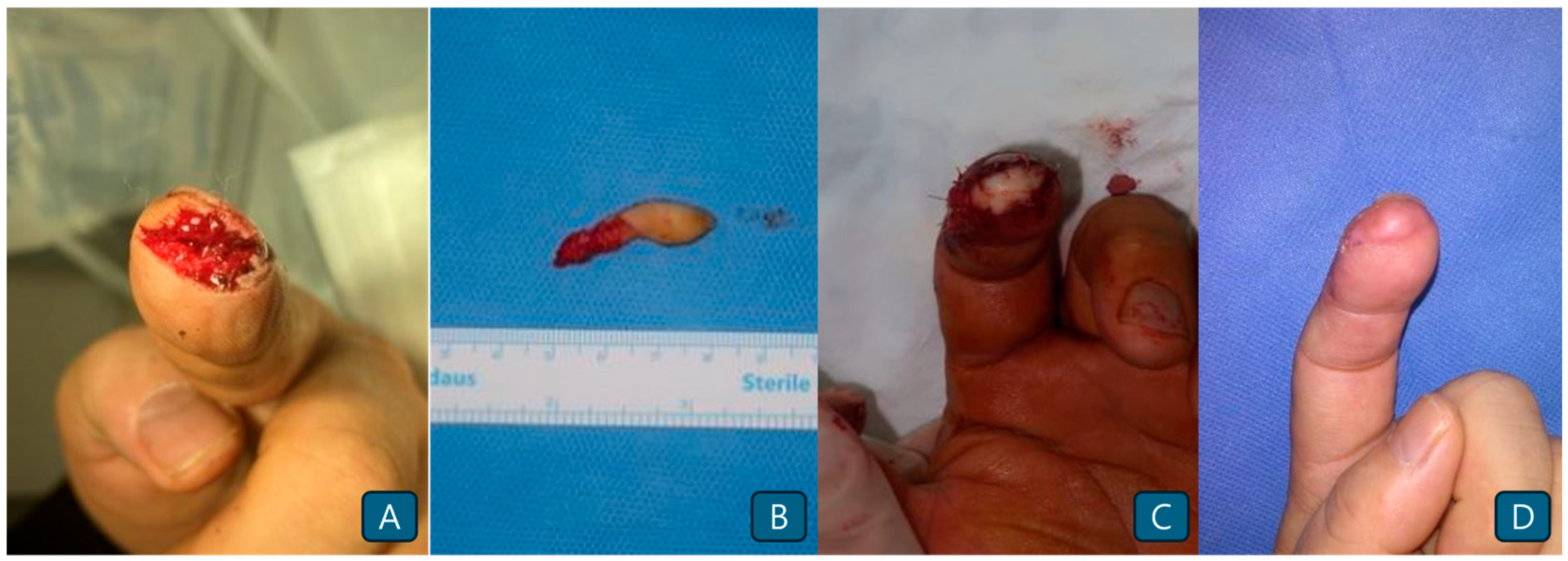 Jcm 14 05855 g004 Jcm 14 05855 g004