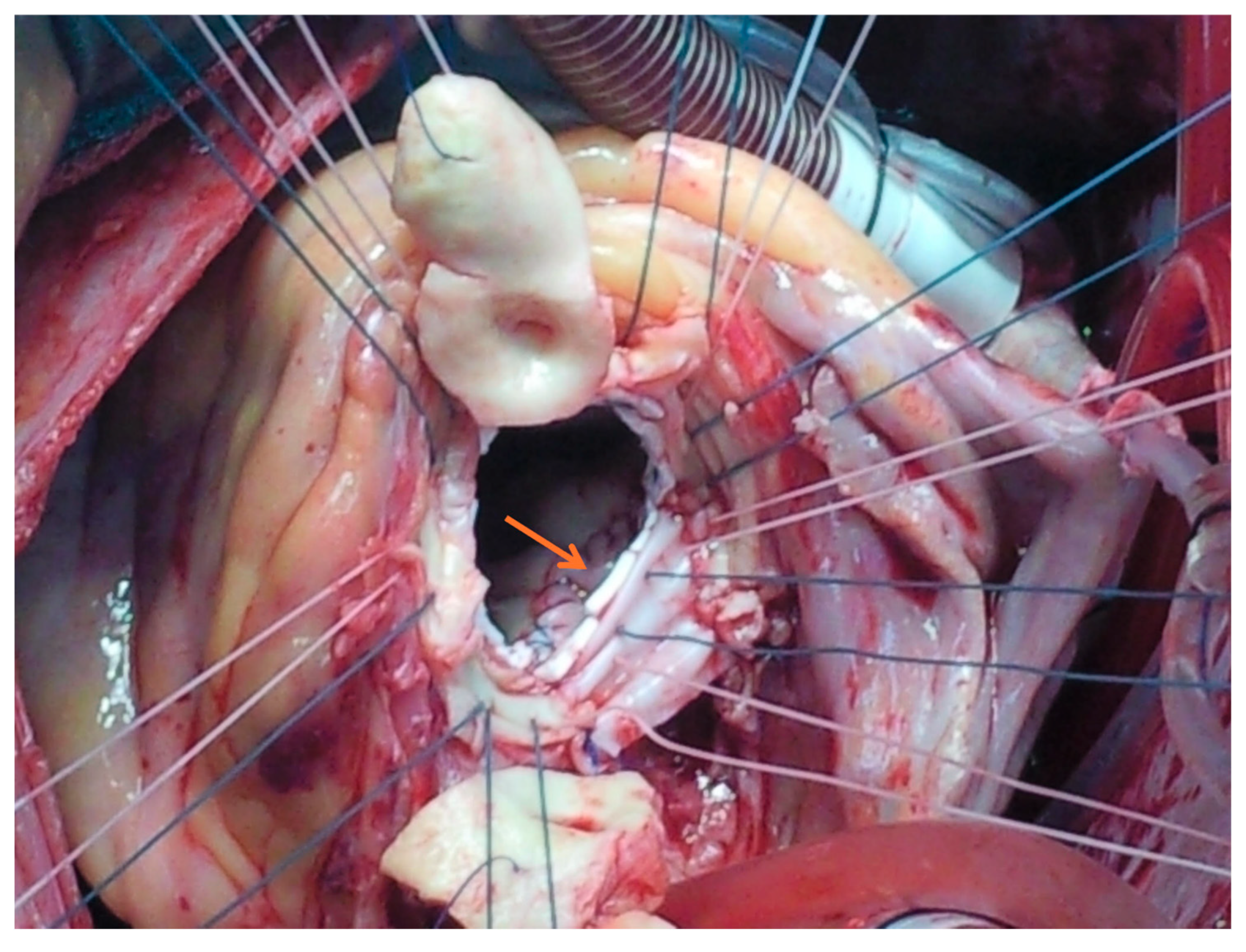 Jcm 14 05870 g001 Jcm 14 05870 g001