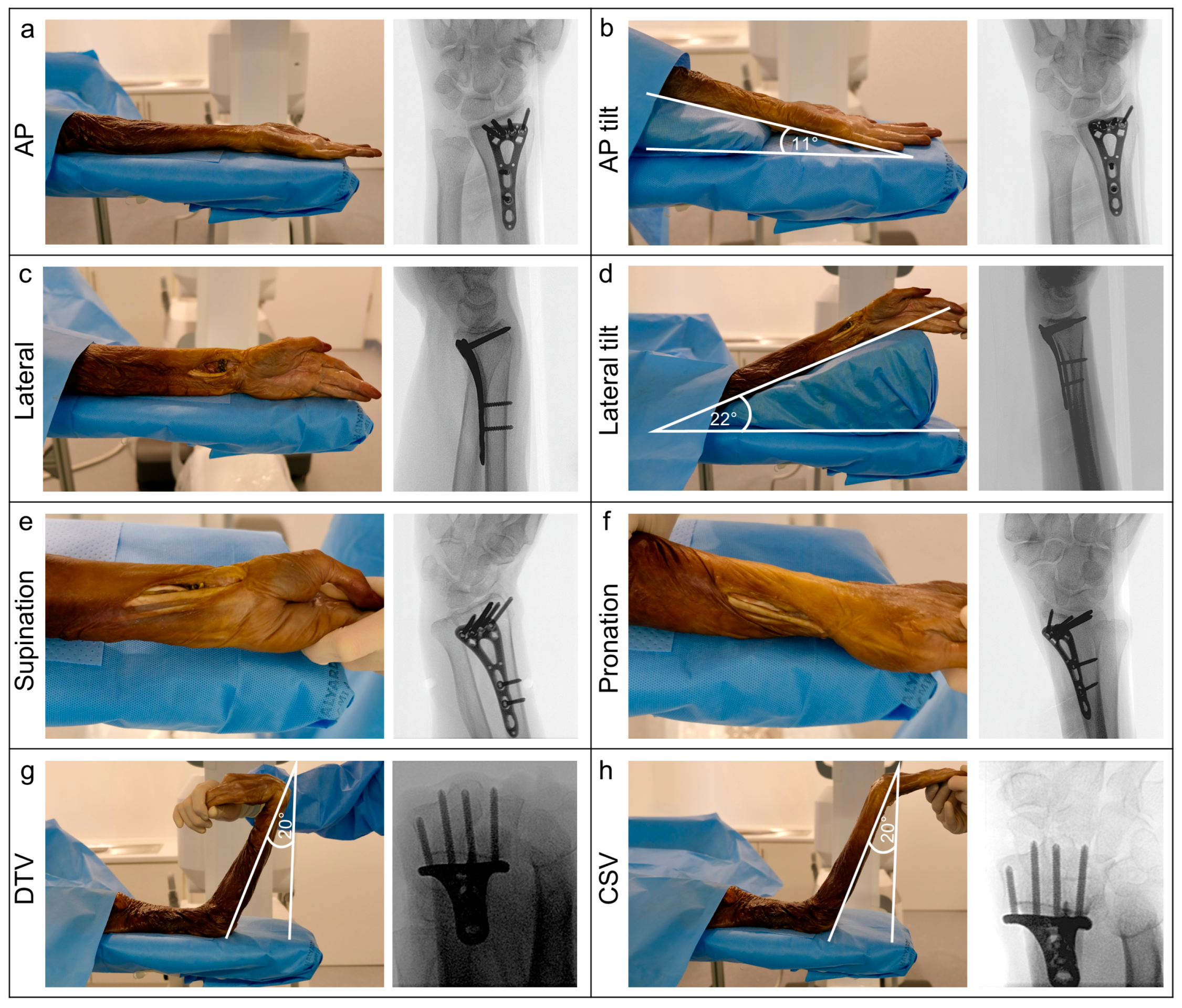 Jcm 14 05896 g002 Jcm 14 05896 g002