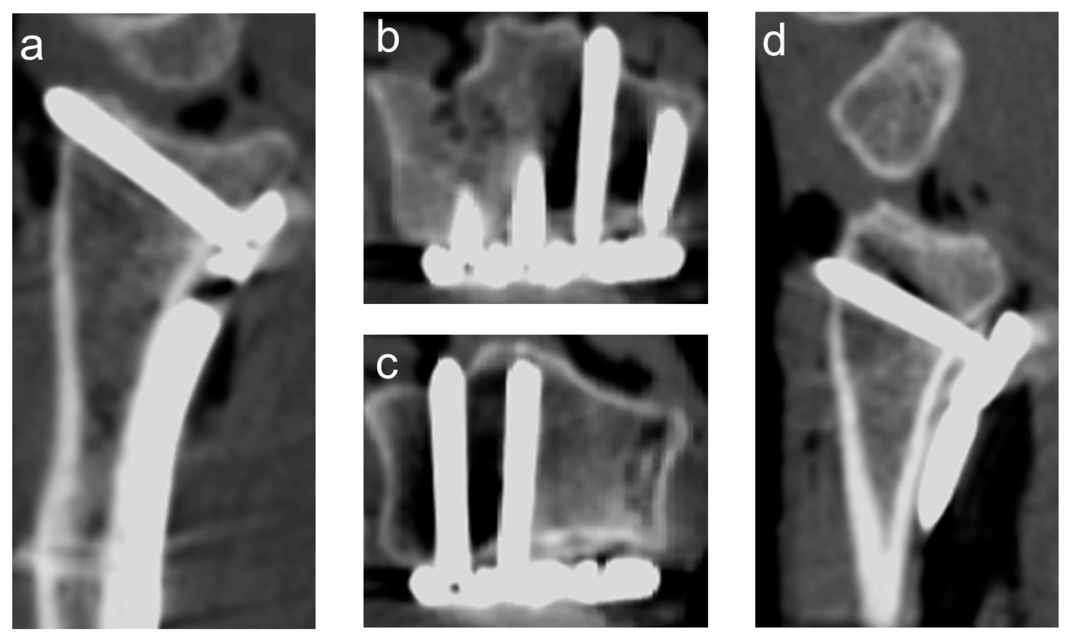 Jcm 14 05896 g003 Jcm 14 05896 g003