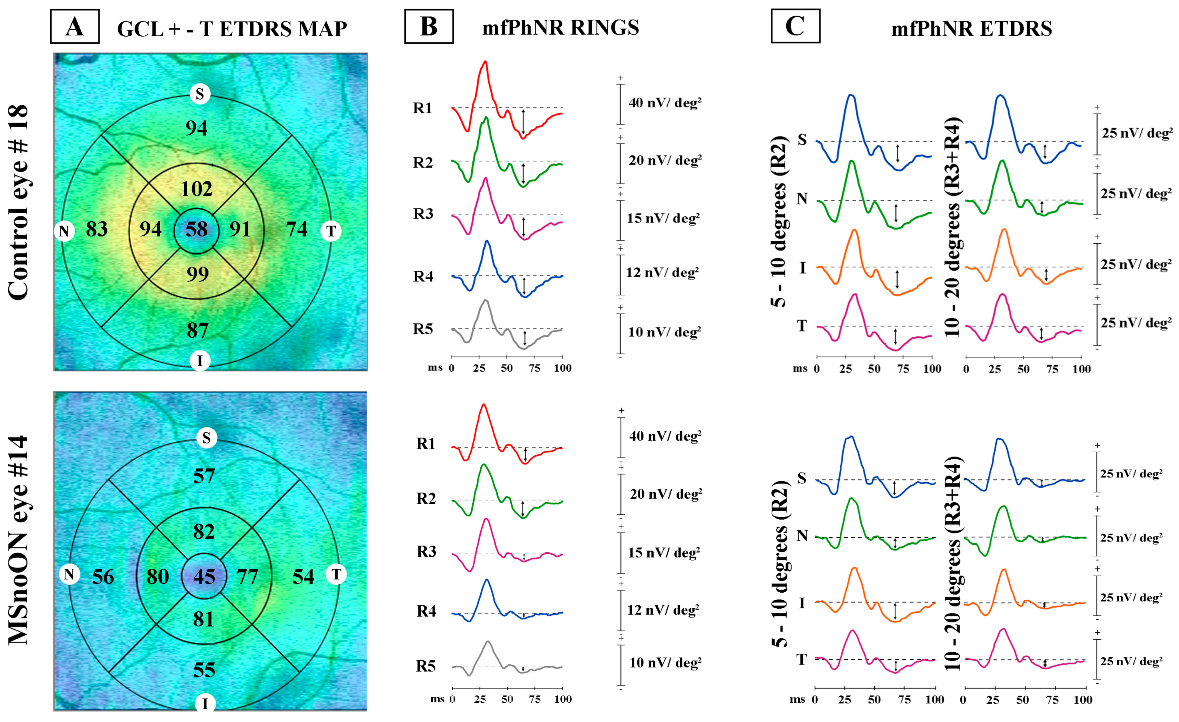 Jcm 14 05919 g001 Jcm 14 05919 g001