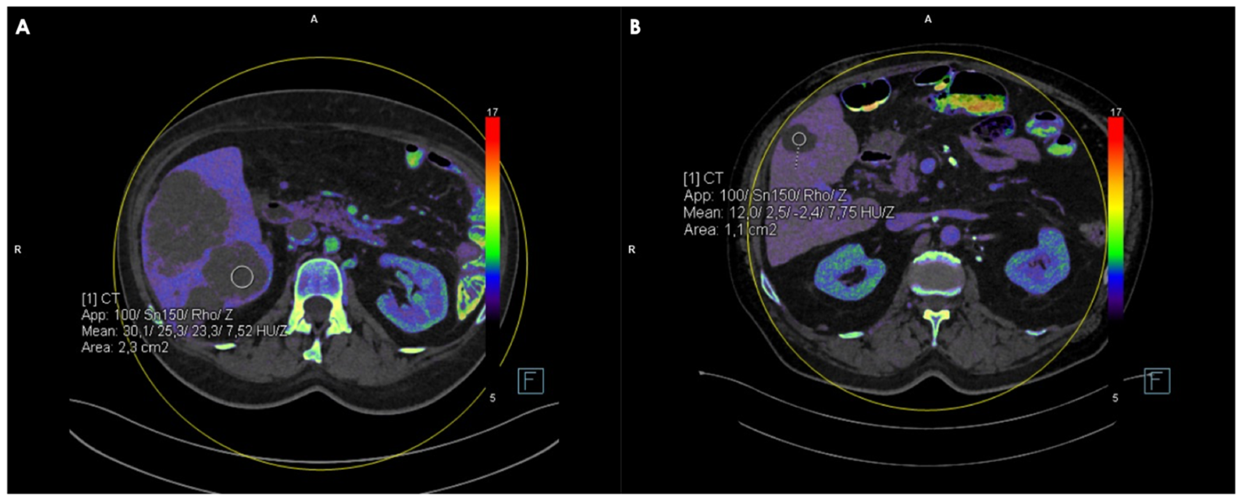 Jcm 14 05929 g002 Jcm 14 05929 g002