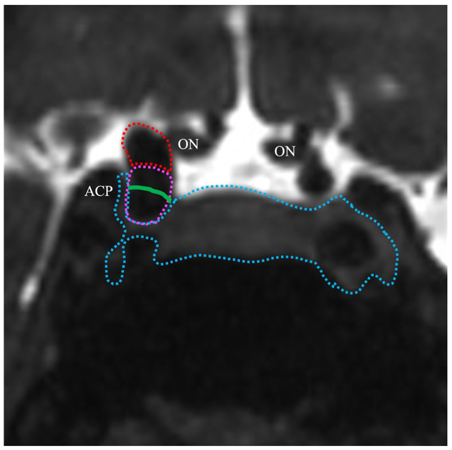Jcm 14 05951 g004 Jcm 14 05951 g004
