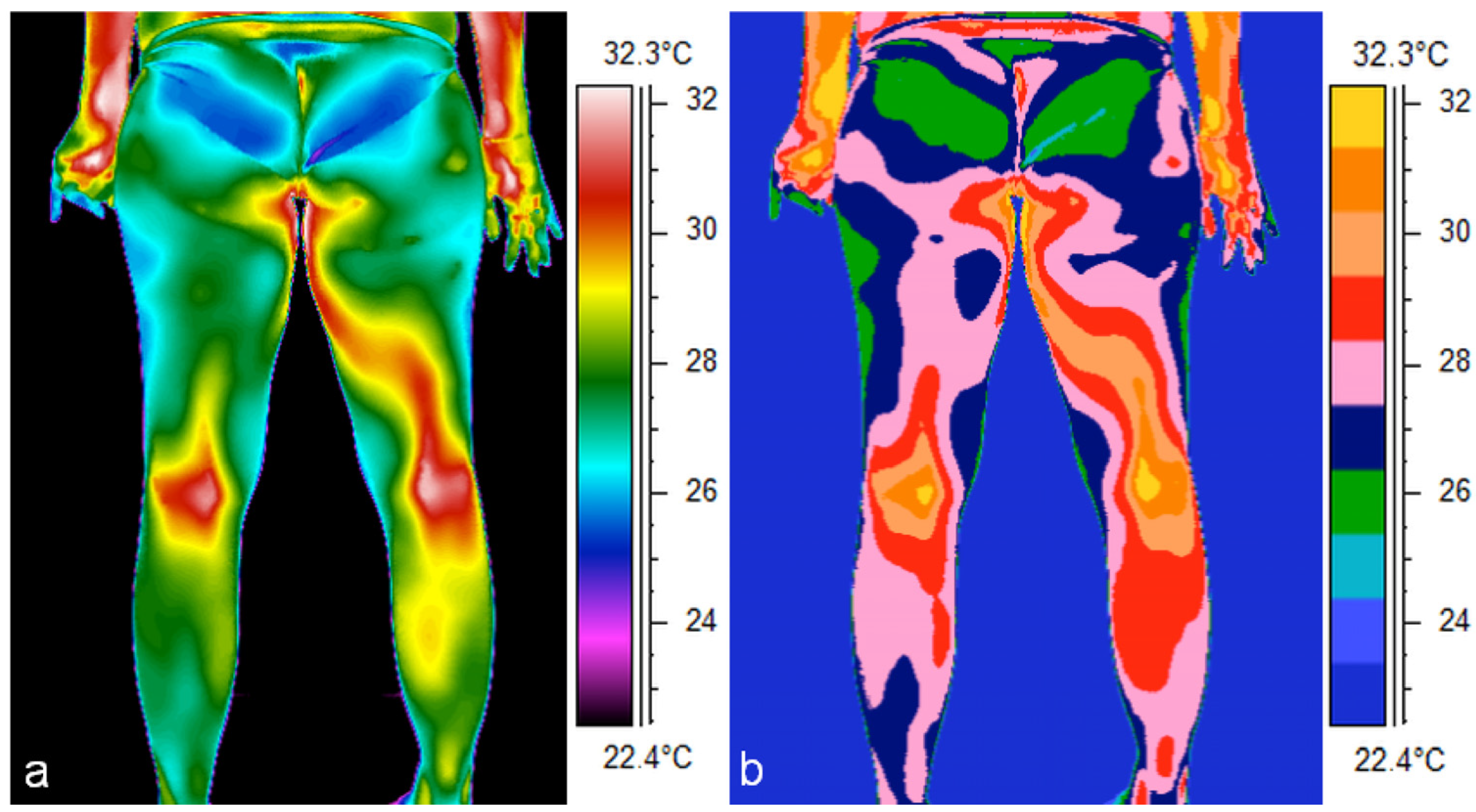 Jcm 14 05998 g004 Jcm 14 05998 g004