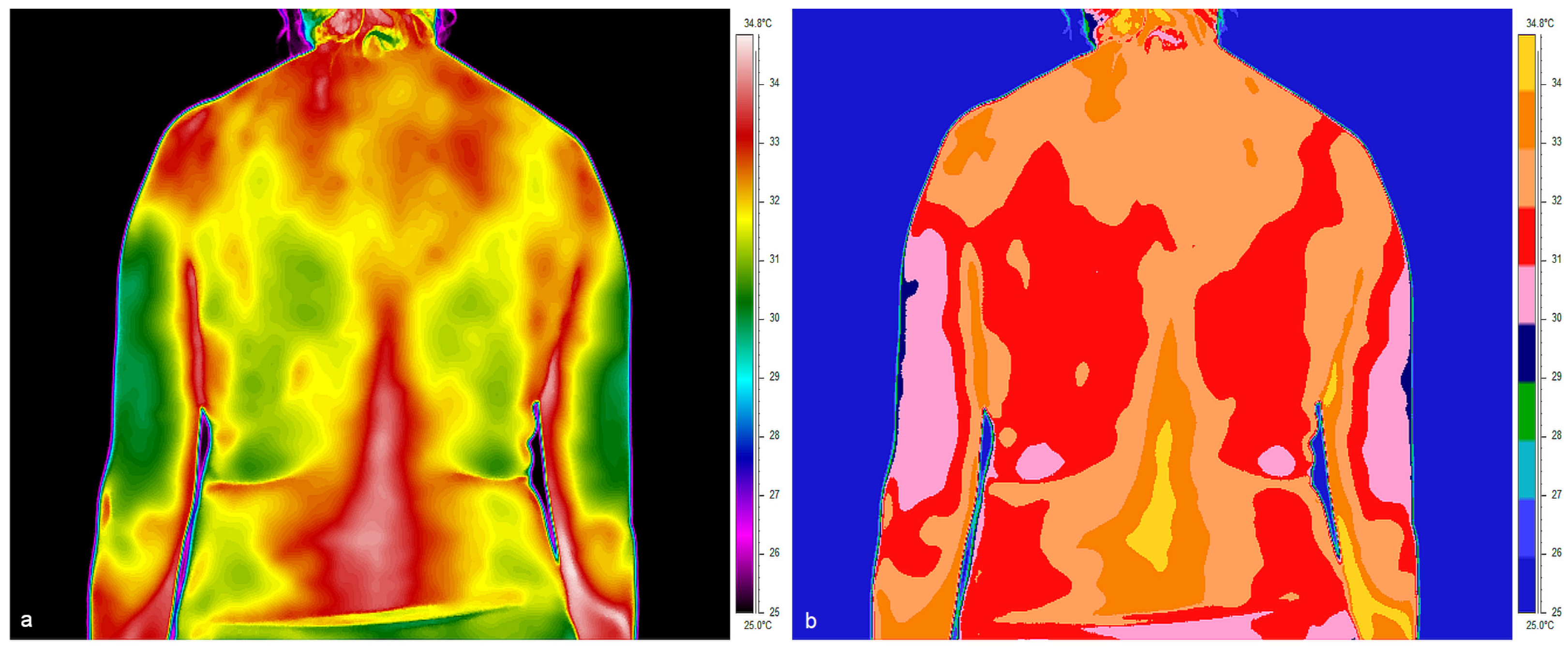 Jcm 14 05998 g005 Jcm 14 05998 g005